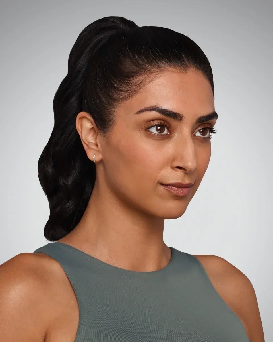 Before  Voluma cheek filler