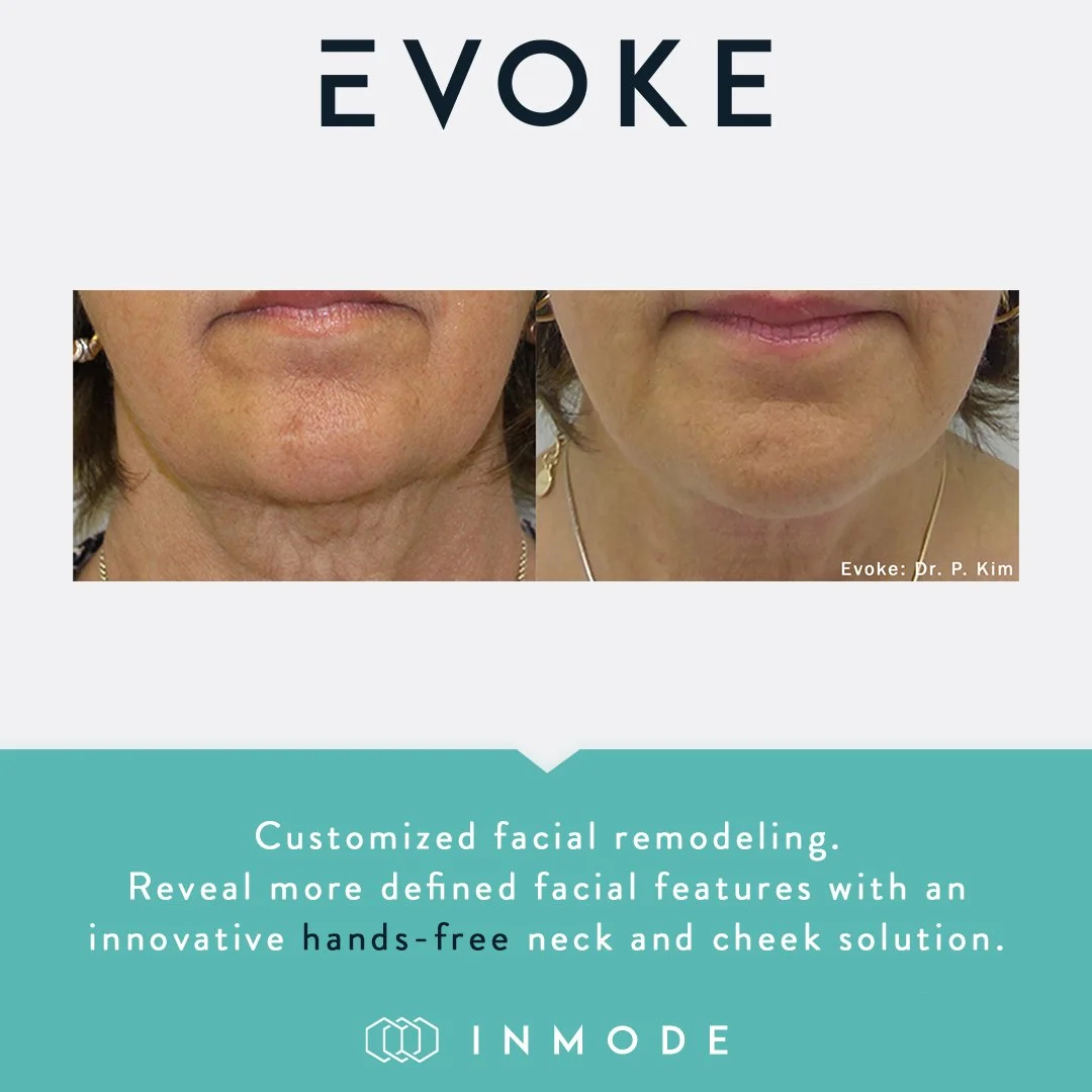 Side-by-side before and after images of a woman's lower face showing improved skin and reduced wrinkles following facial remodeling treatment by Dr. P. Kim, with promotional text for customized facial remodeling by InMode.