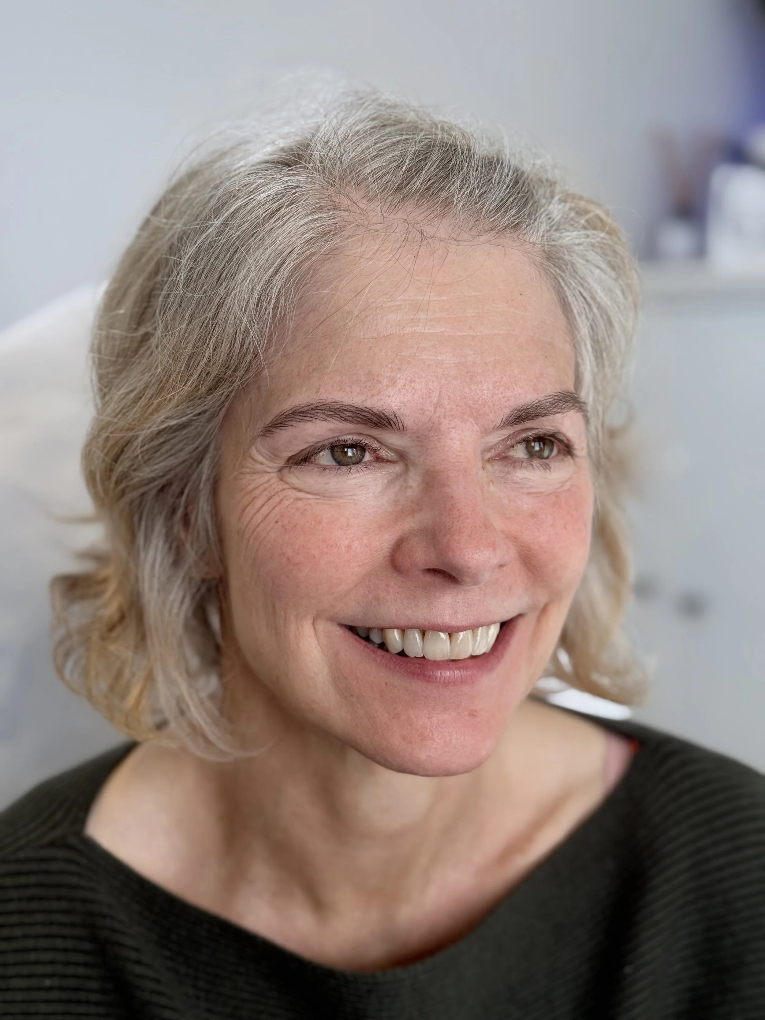 Eyebrow Loss During Cancer Treatment: Gentle options before you heal