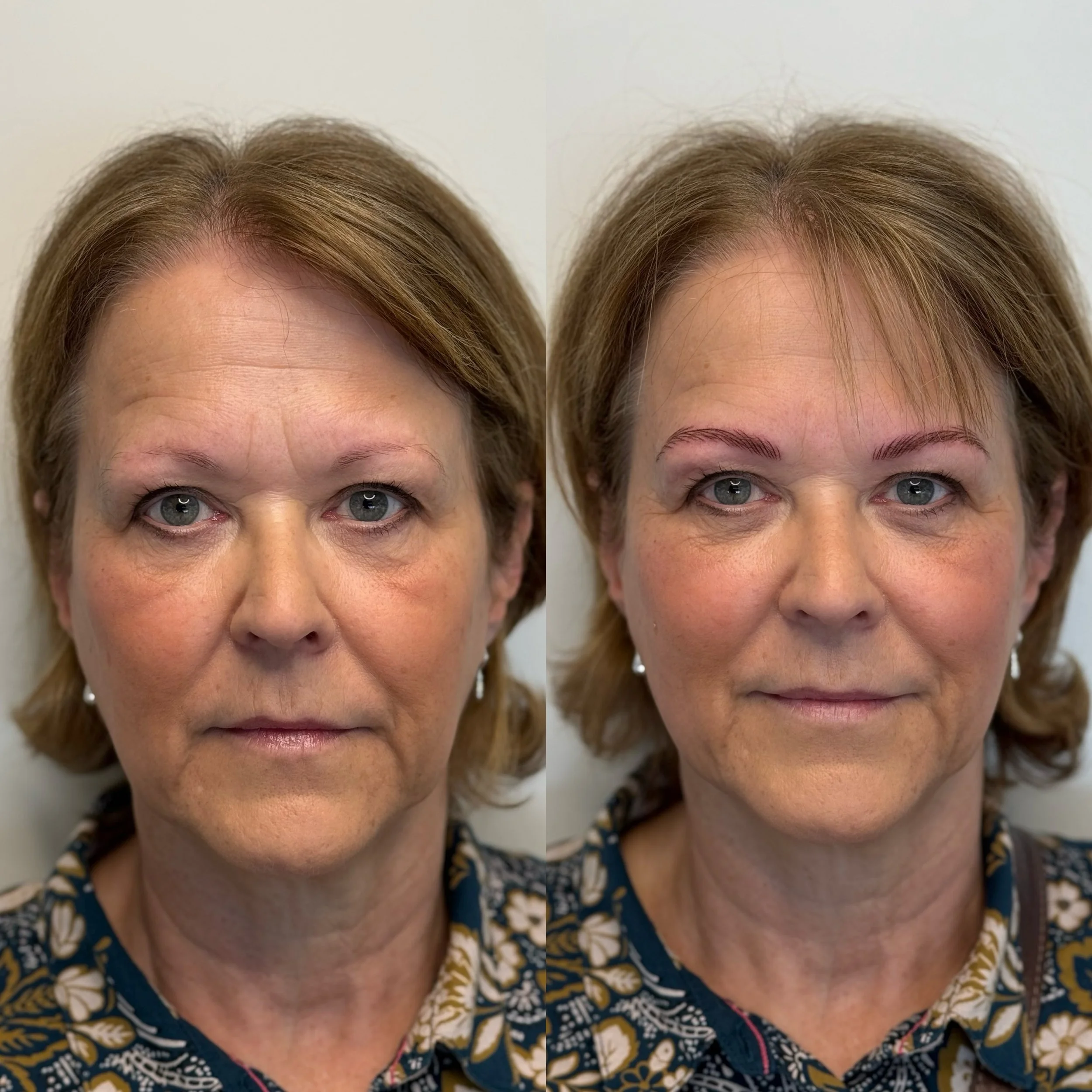 Facetune_30-03-2025-13-36-02.jpg