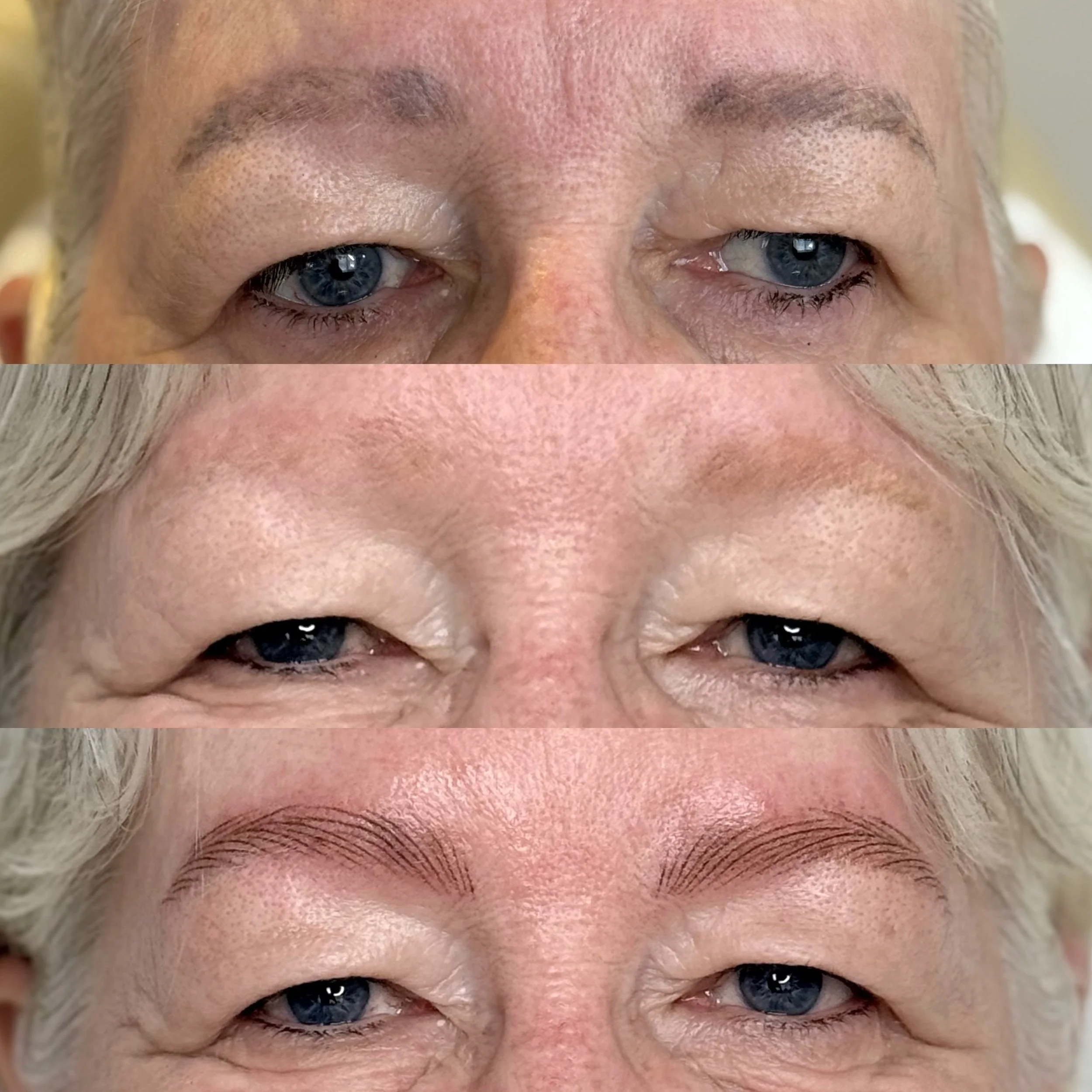 Laser Tattoo Removal Cambridge — Close-up of a person with mature skin focusing on the eyes, eyebrows, and forehead — Cambridge Brow Sanctuary