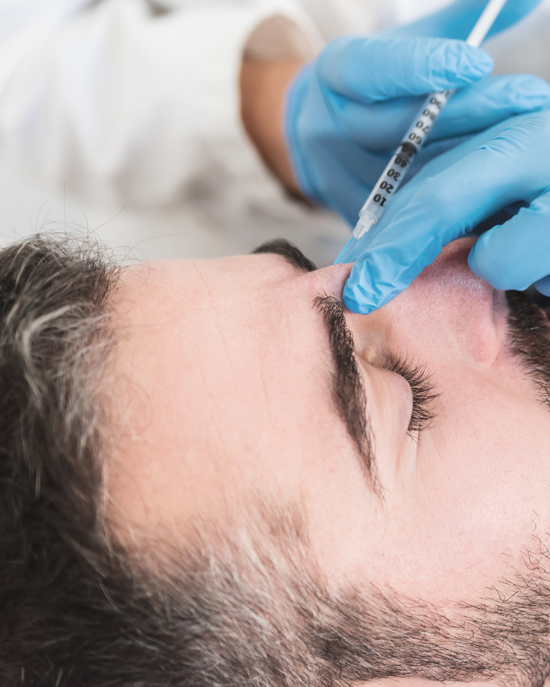 Botox Demystified: How Neuromodulators Smooth Wrinkles and Prevent Future Lines