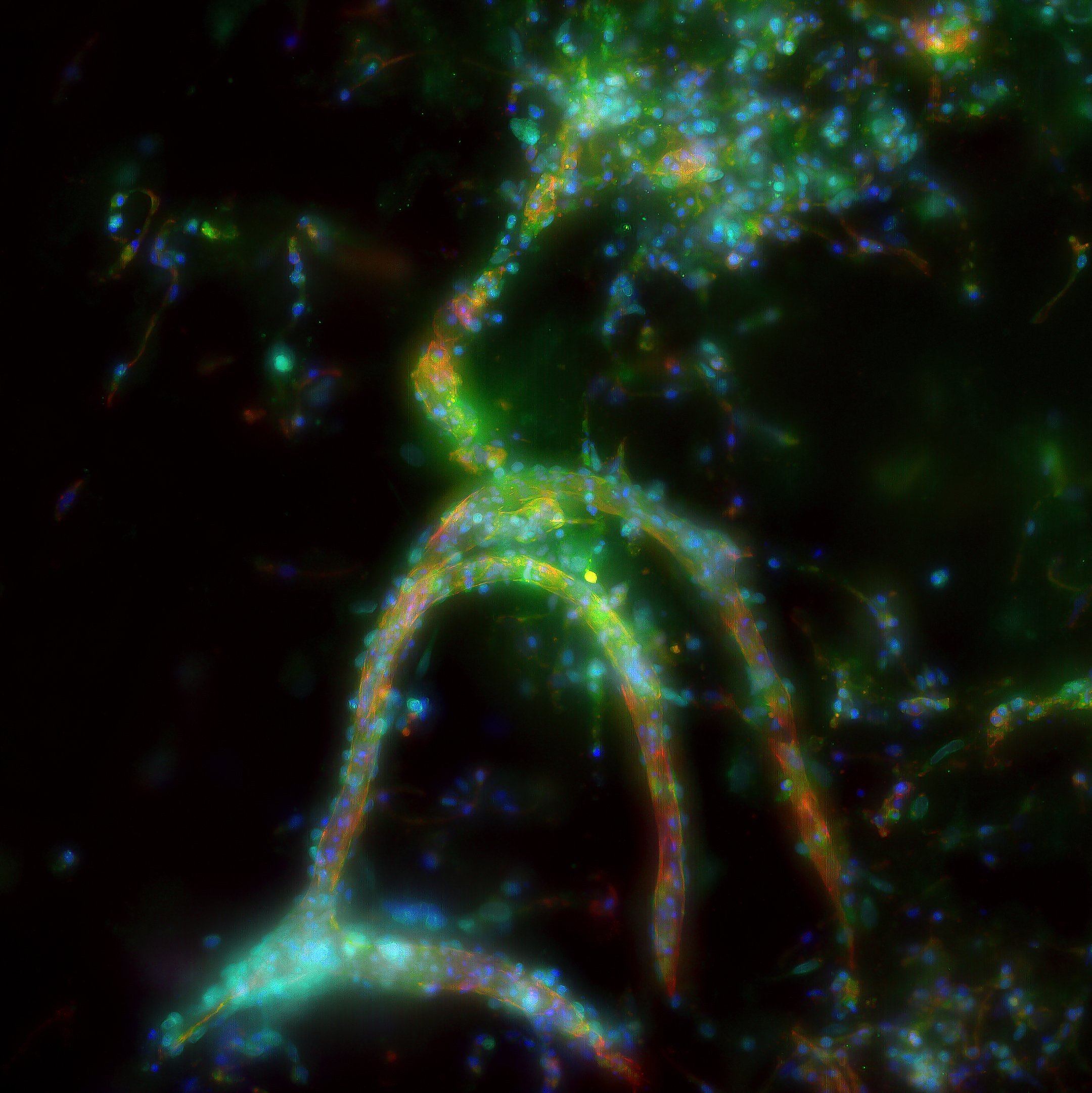 Understanding Sepsis: Uncovering What Goes Wrong in the Body’s Smallest Blood Vessels