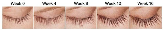 Lumigan Effective results in 16 Weeks at My London Pharmacy