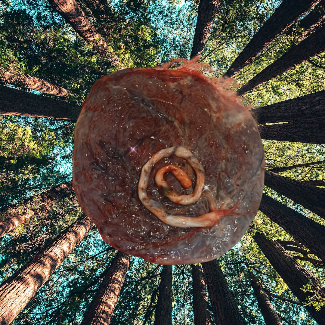 Close-up of a placenta with the umbilical cord set against a background of tall trees and a bright sky respresenting the tree of life that comes after birthing a baby