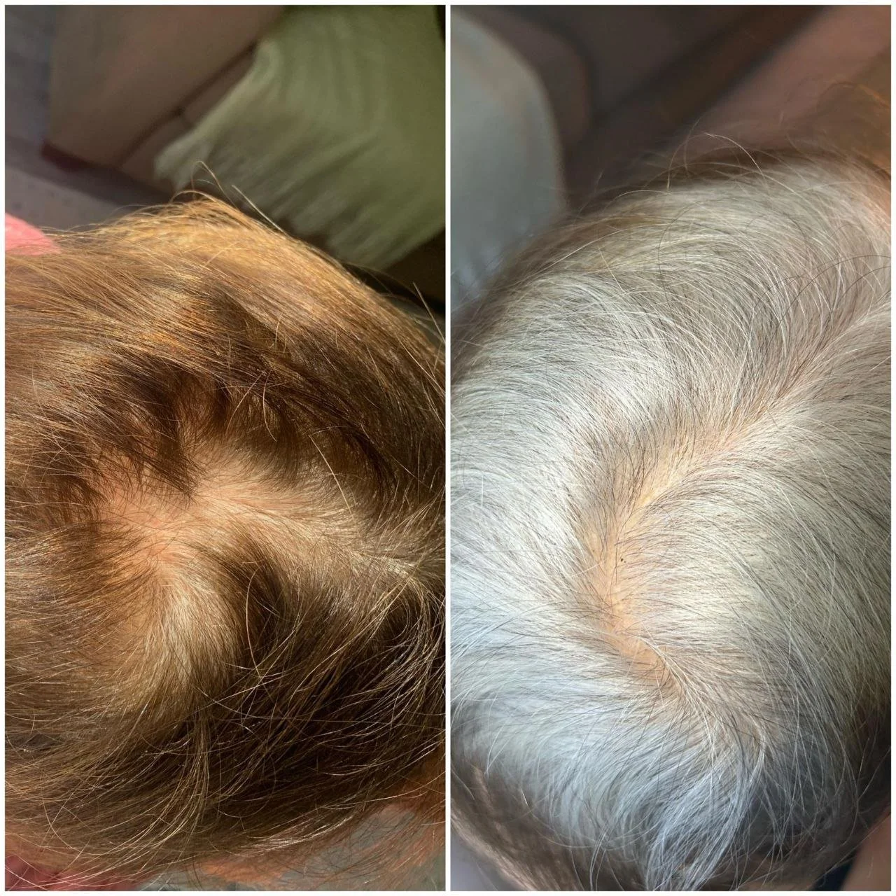natural organic professional hair restoration increase hair density, thinning hair treatments, prevent hair loss, with elapromed scalp treatments winnipeg osborne, st vital