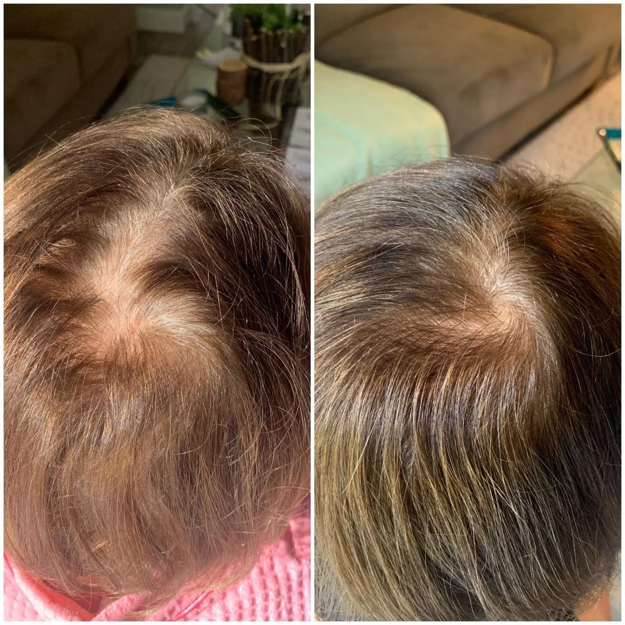 natural organic professional hair restoration hair increase hair density, thinning hair treatments, prevent hair loss, with elapromed microcurrent electroporation, dry scalp treatments winnipeg osborne, st vital