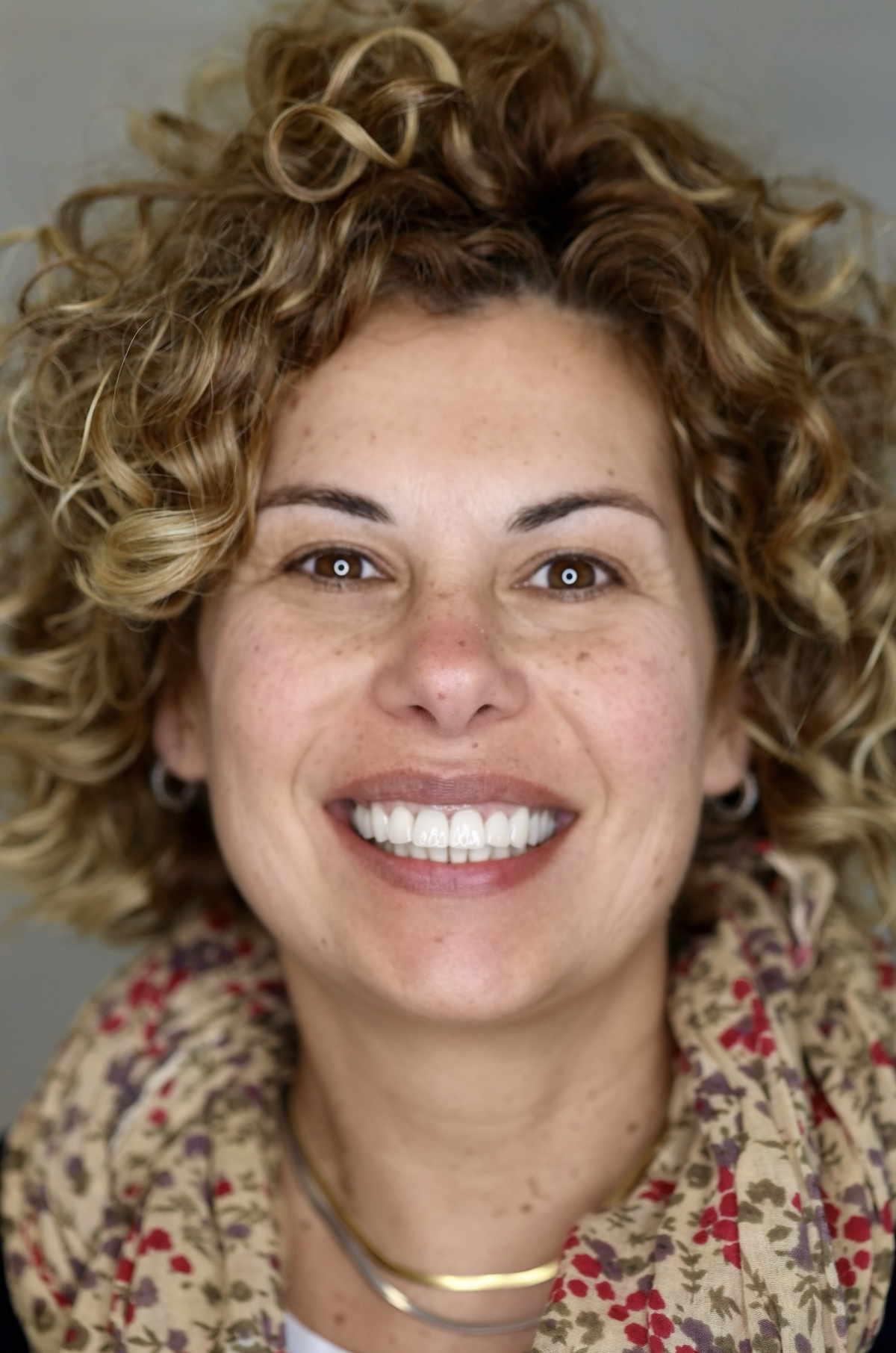 Sorriso naturale dopo il trattamento di odontoiatria estetica