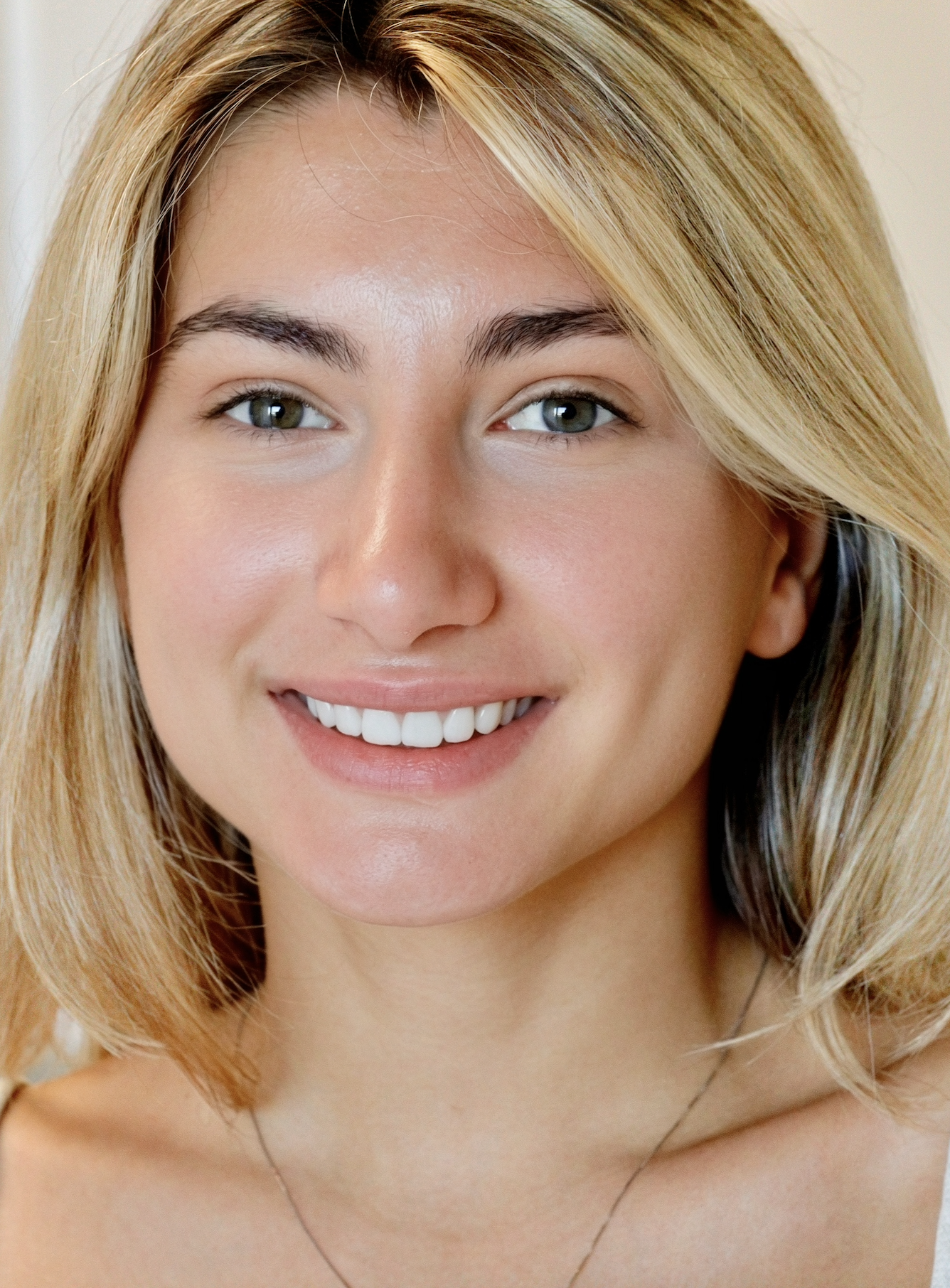 Sorriso naturale dopo il trattamento di odontoiatria estetica