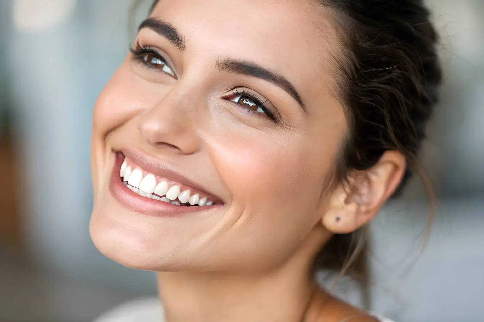 Prima e dopo trattamento con faccette dentali a Bari