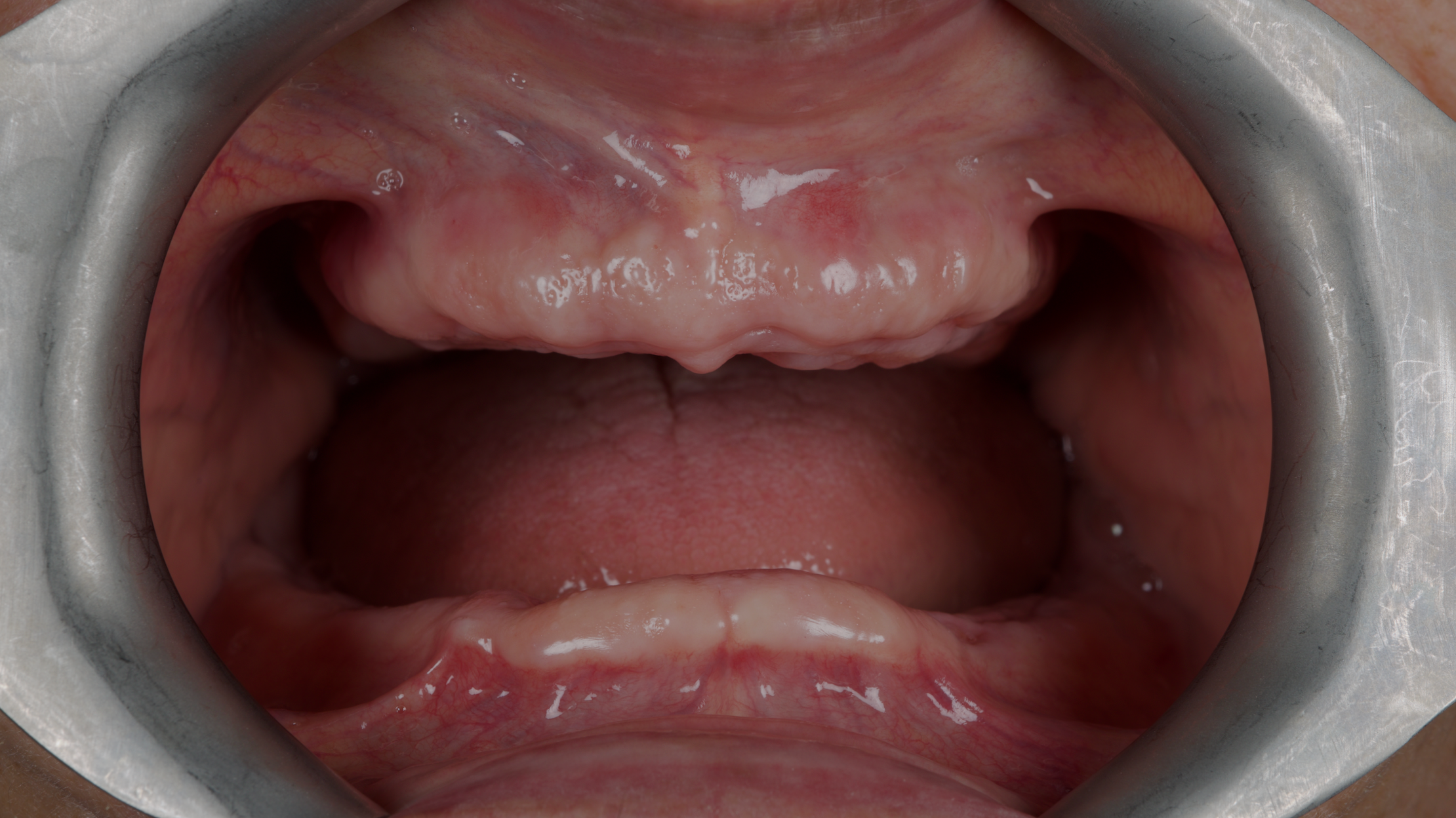 Sorriso naturale prima del trattamento di odontoiatria estetica