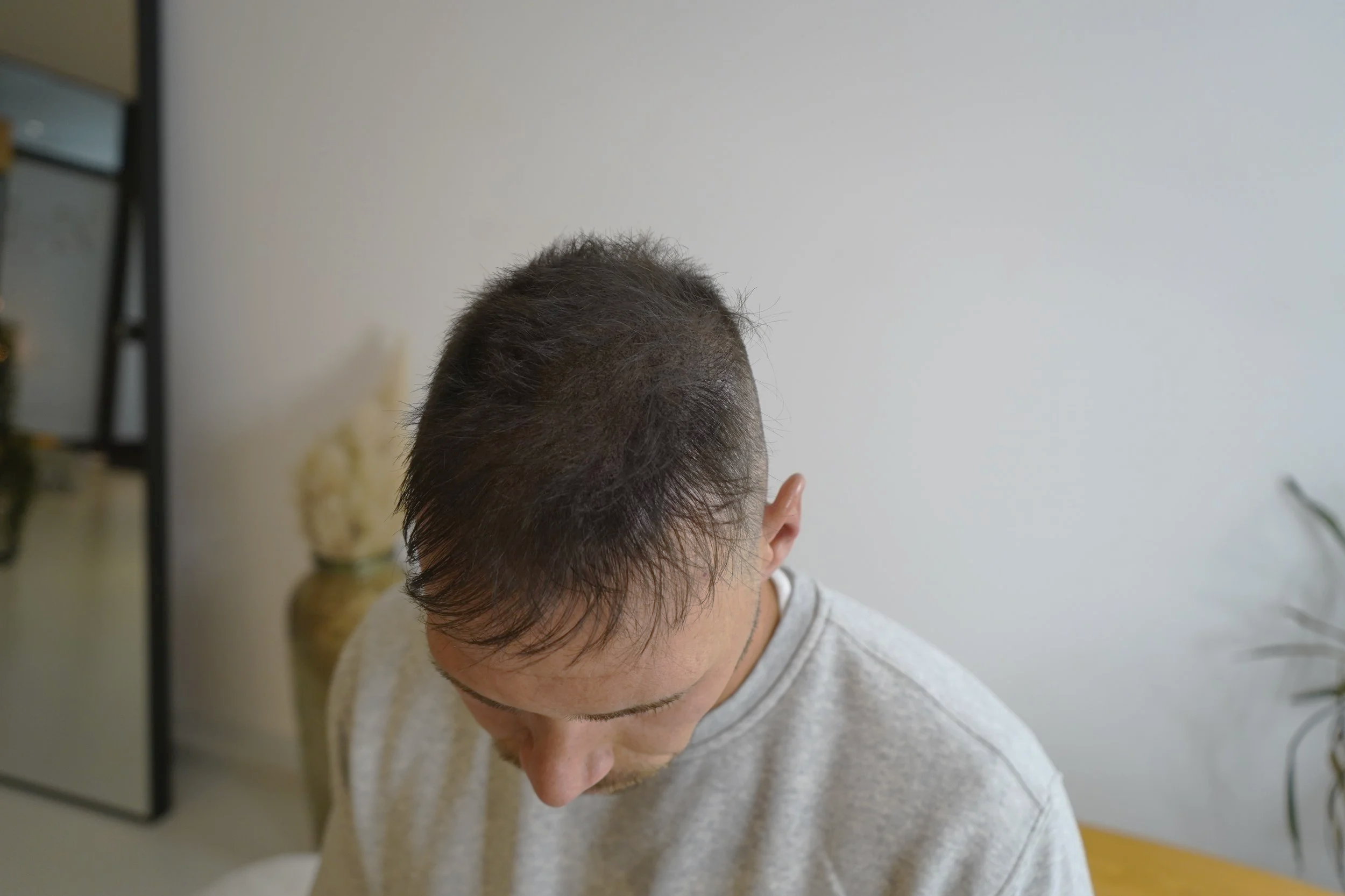 lichtes haar verdichtet