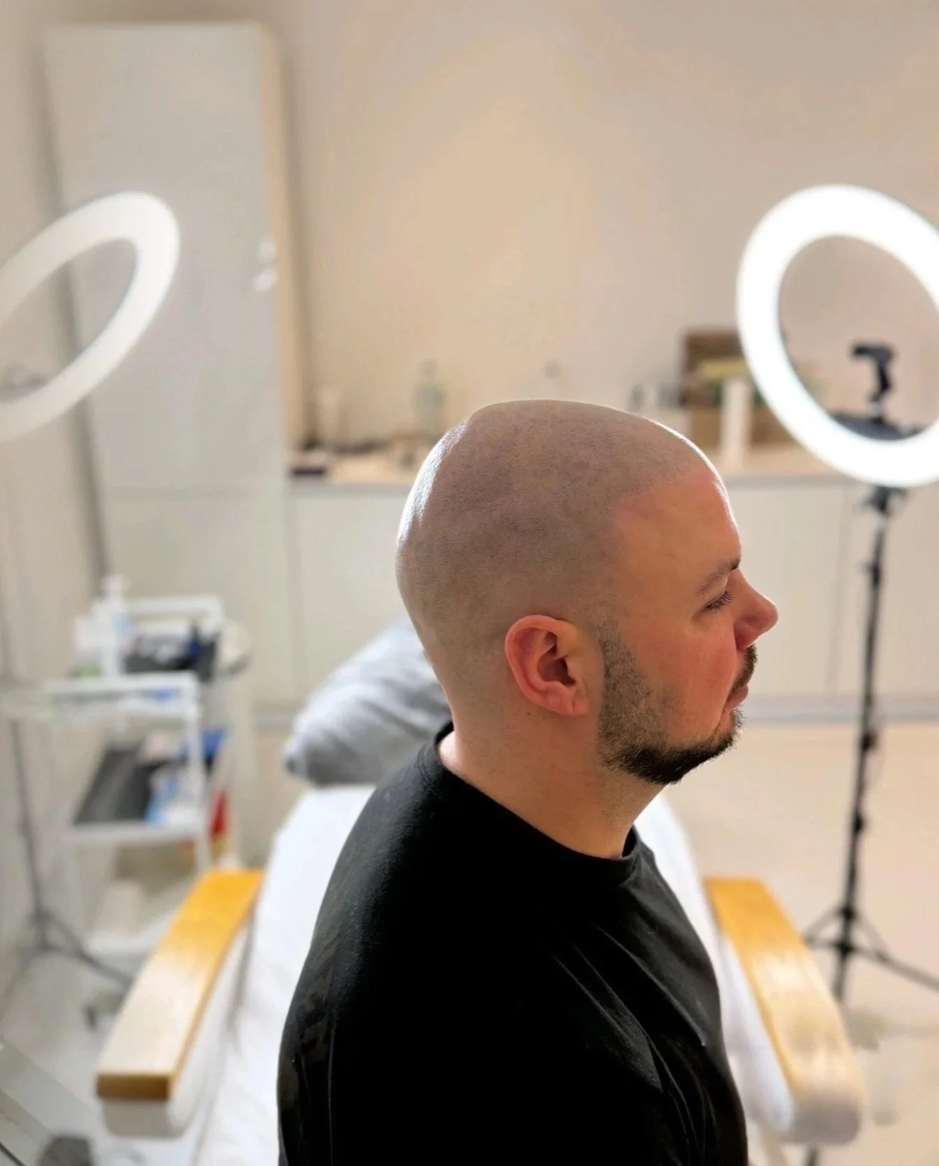 mann mit haarpigmentierung