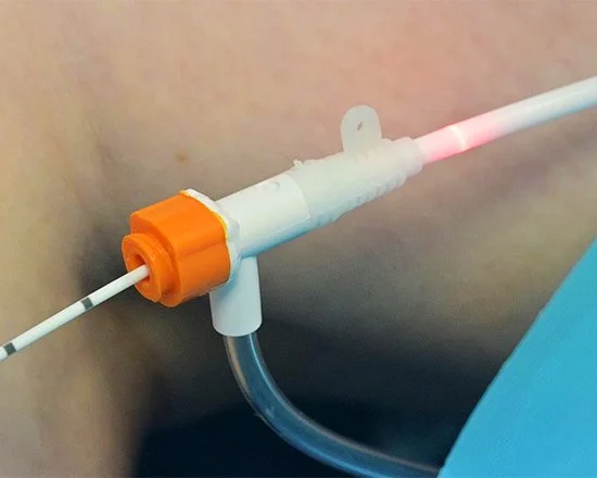 Medical device with a white and orange connector attached to a tube, emitting a red light, positioned against a person's skin.