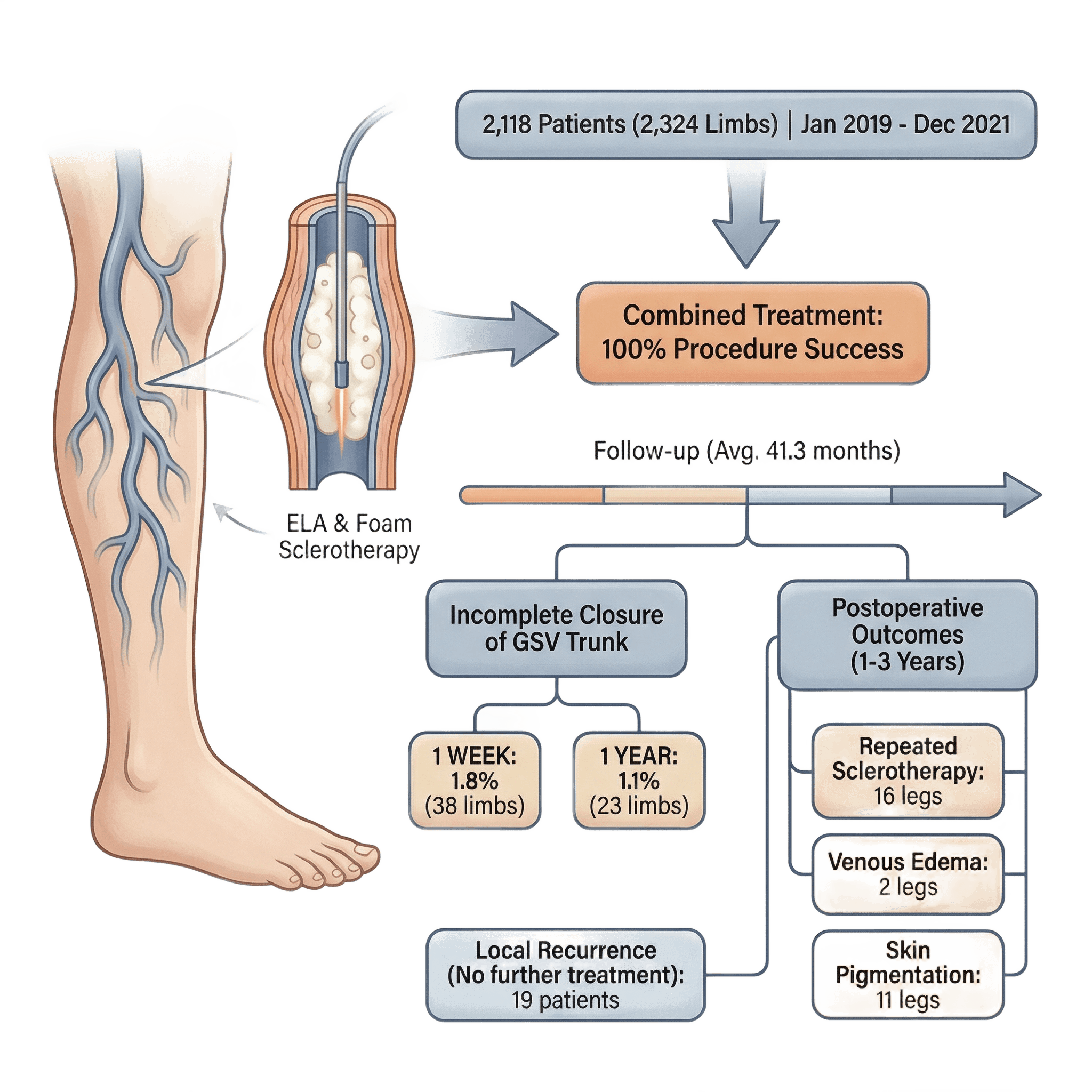 Innovative Varicose Vein Treatment: Long-Term Success with ELA & Foam Sclerotherapy
Are you seeking a proven, minimally invasive solution for varicose veins? Our center recently completed an extensive study tracking the long-term health of over 2,100