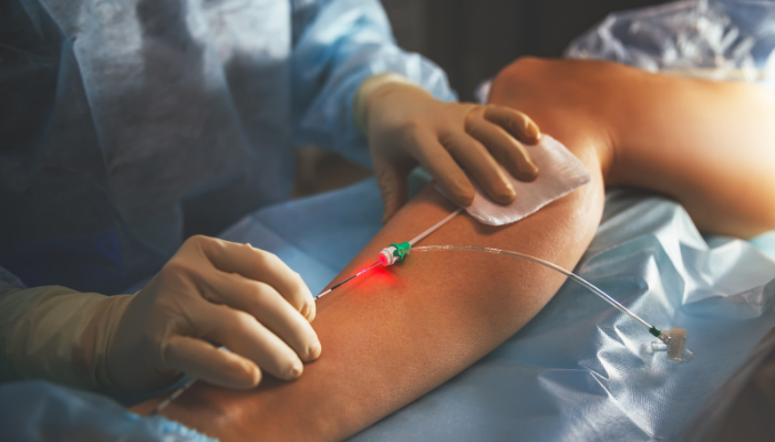 Medical professional performing intravenous therapy on patient's arm in a clinical setting.