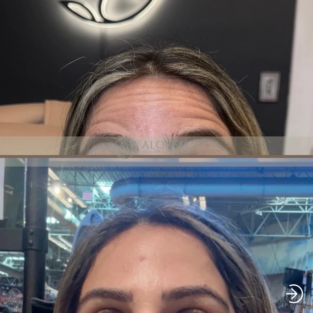 BA Botox Meux.zip - 2.png