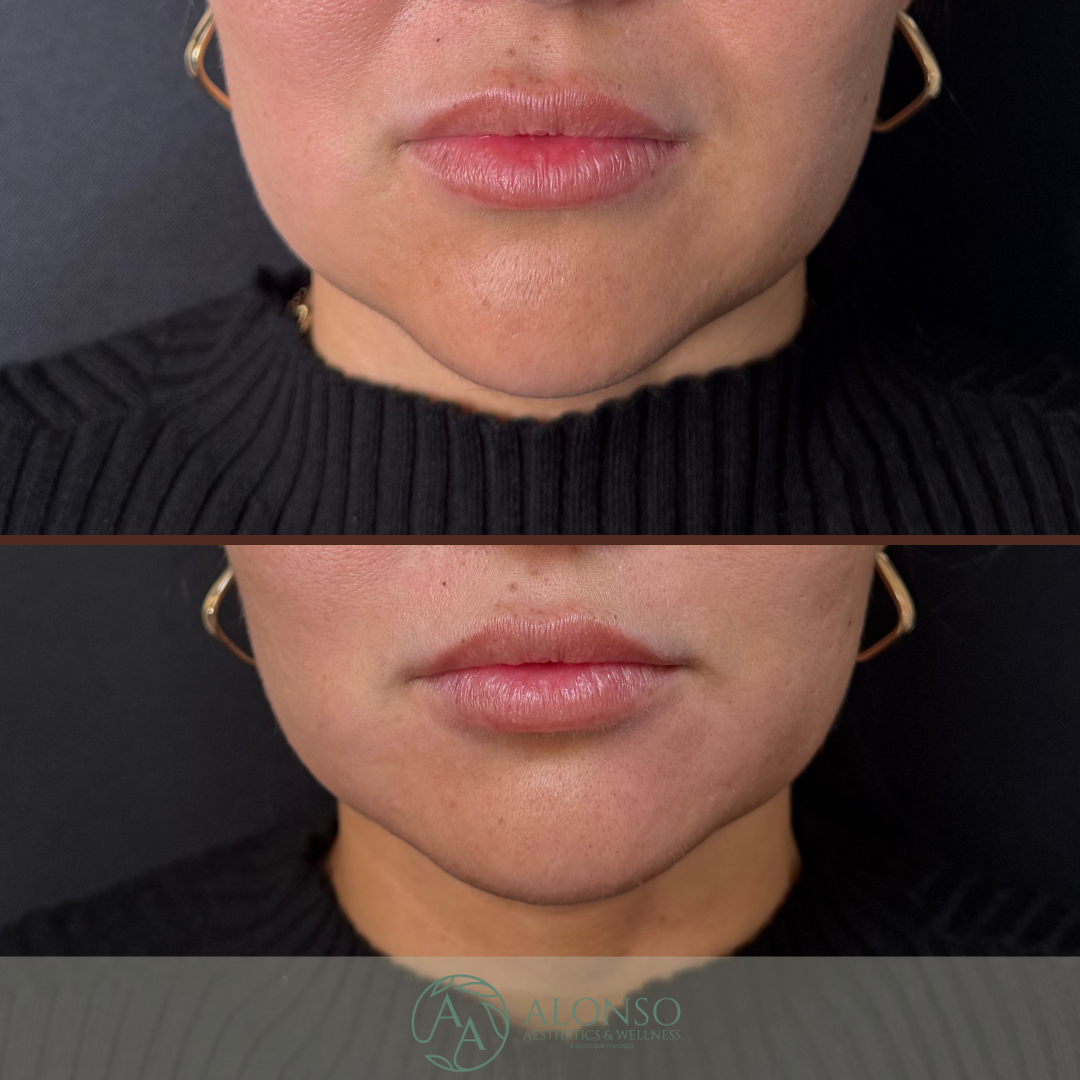 Copy of Kelli Lips.zip - 3.png
