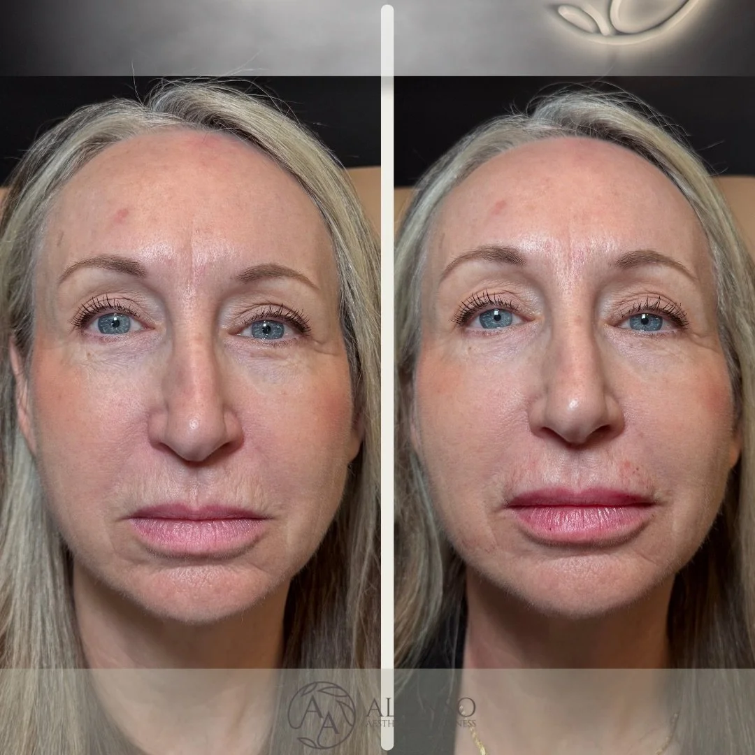 Copy of Copy of Kelli Lips.zip - 1.png