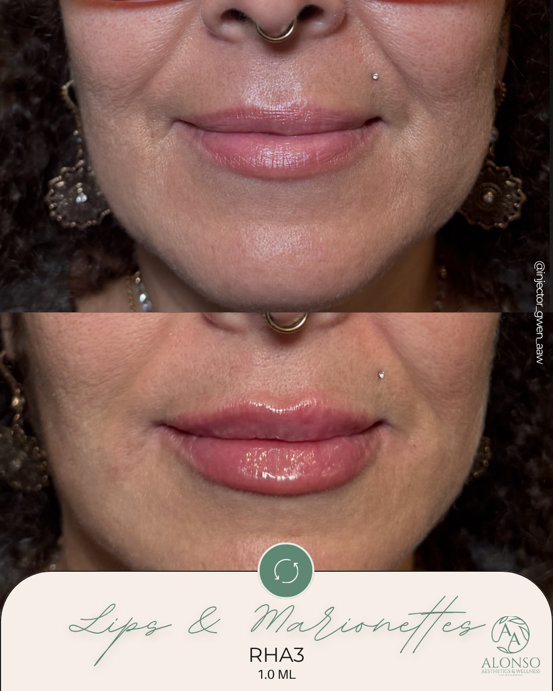 Lorraine Lips 2.png.png