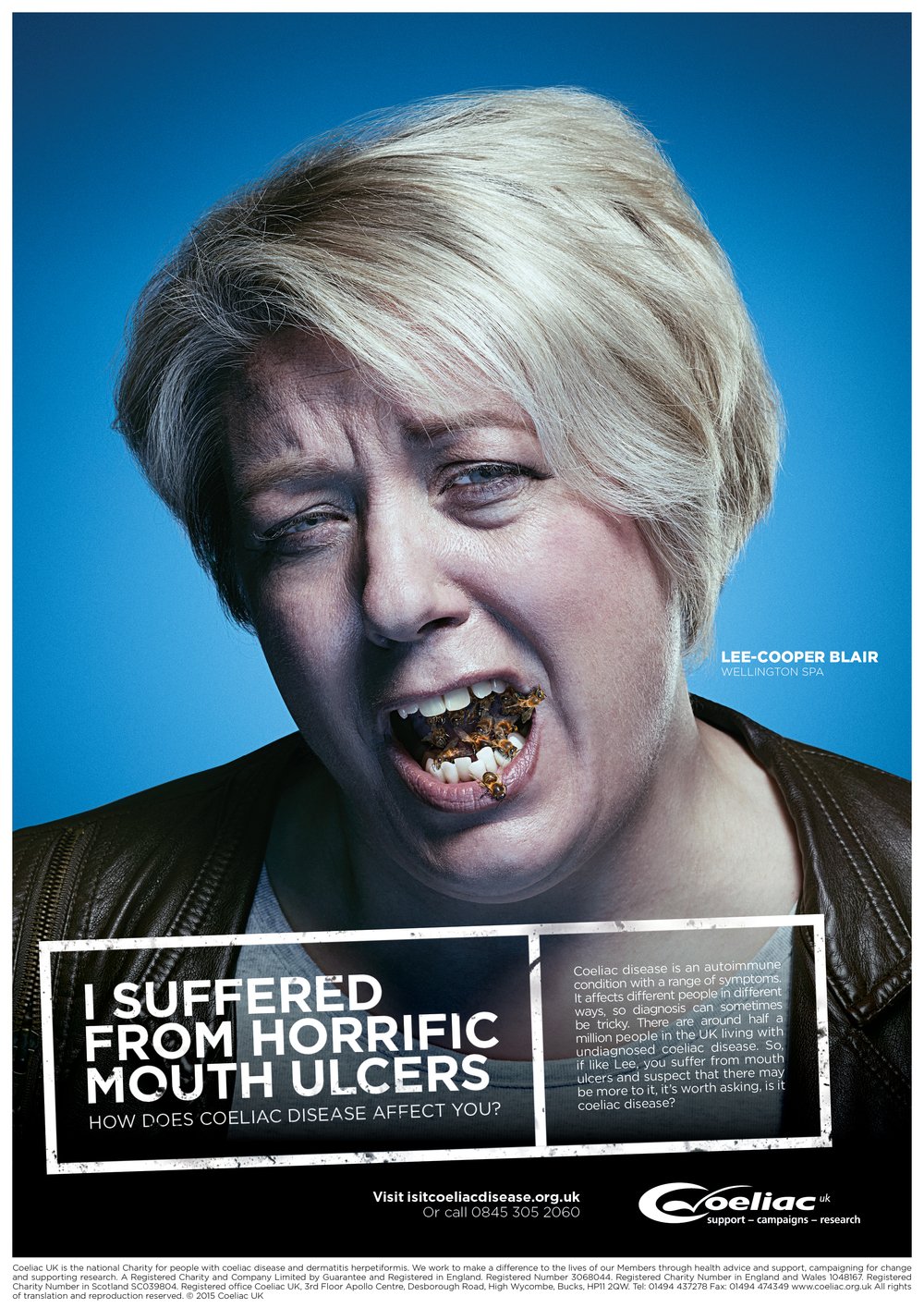 10324470+COELIAC+DIAGNOSIS+CAMPAIGN+POSTERS+CHOSEN+A4.jpg