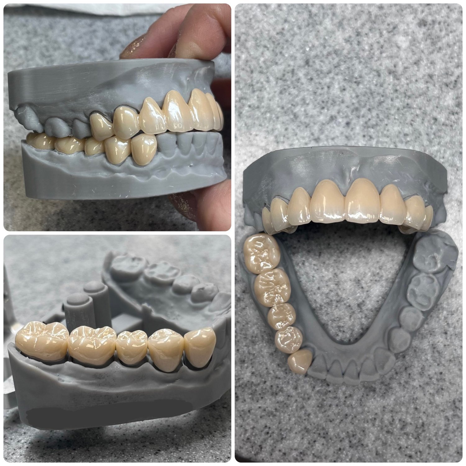 Custom Solutions for Unique Cases: How a Skilled Dental Lab Can Help
