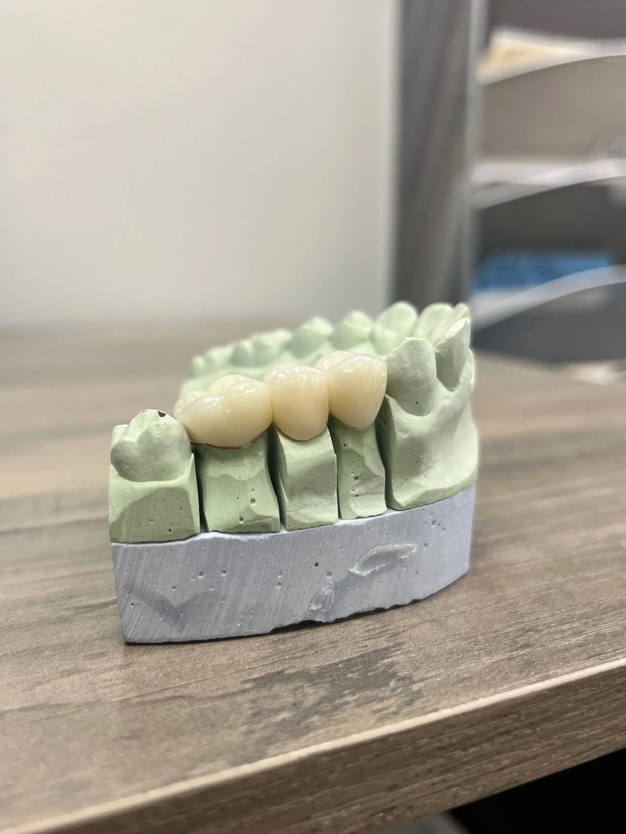 dental-laboratory-near-me-same-day-services-south-austin-texas890.jpg