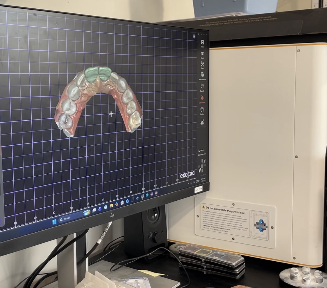 electric-arts-dental-laboratory-near-me-same-day-services-south-austin-texas889.png