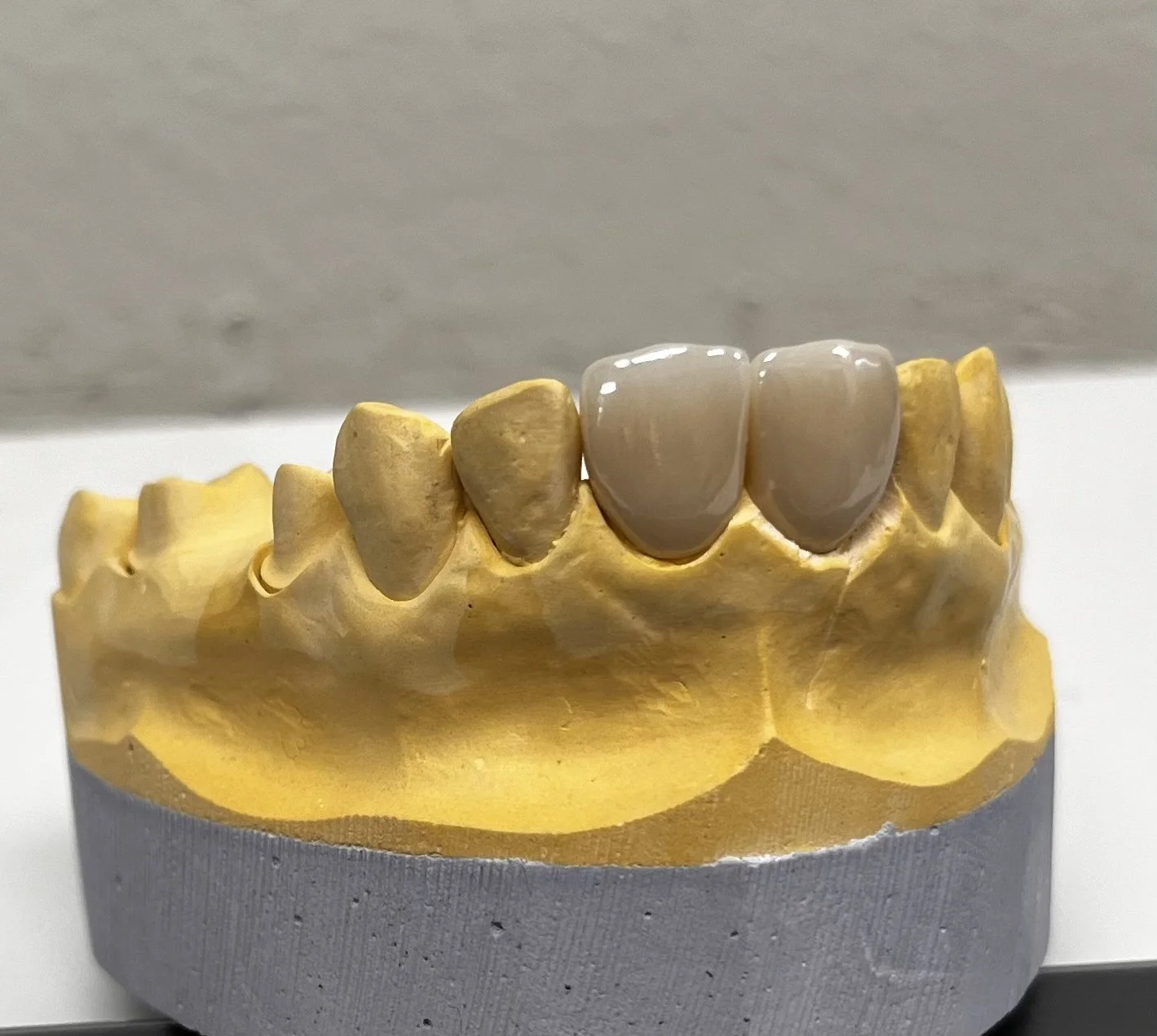 dental-laboratory-near-me-same-day-services-south-austin-texas892.jpeg