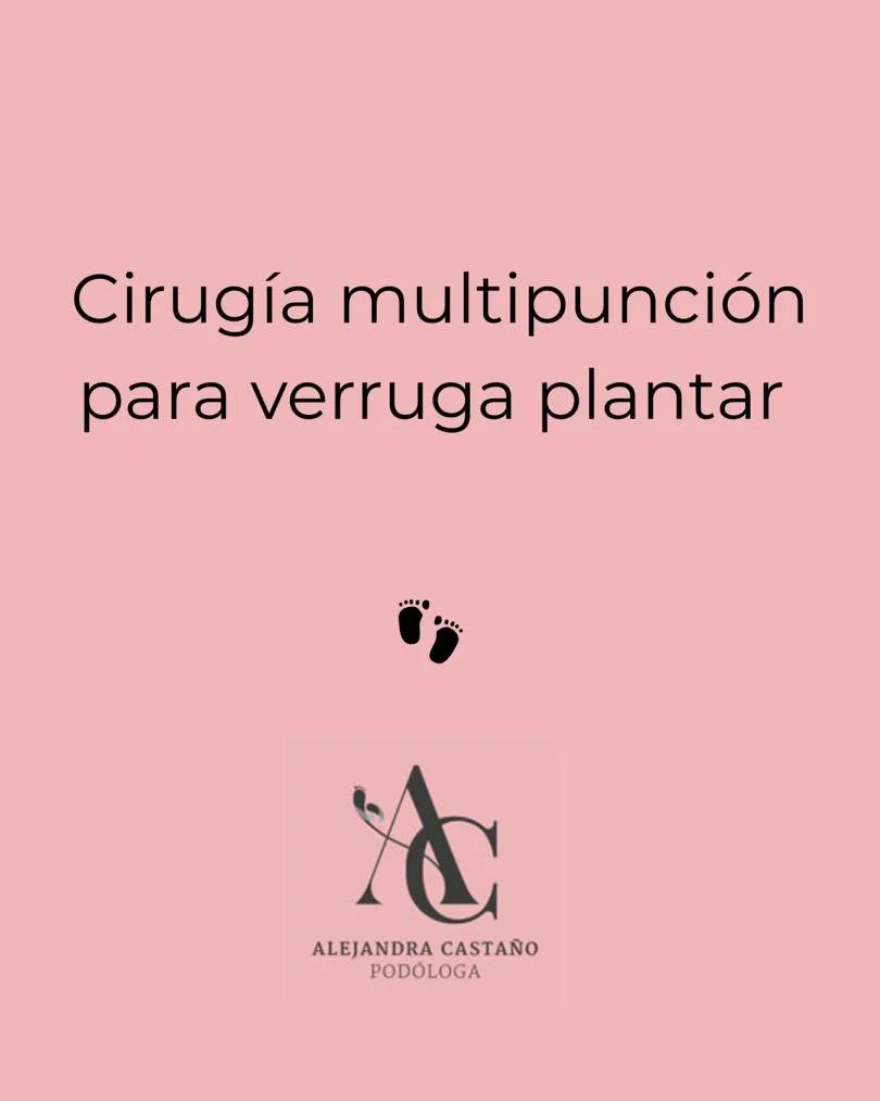 La verruga plantar es una lesi&oacute;n causada por el virus del papiloma humano (VPH) que aparece en la planta del pie. Suele confundirse con un callo, pero a diferencia de este, puede doler al caminar y en ocasiones se observan puntitos negros (cap