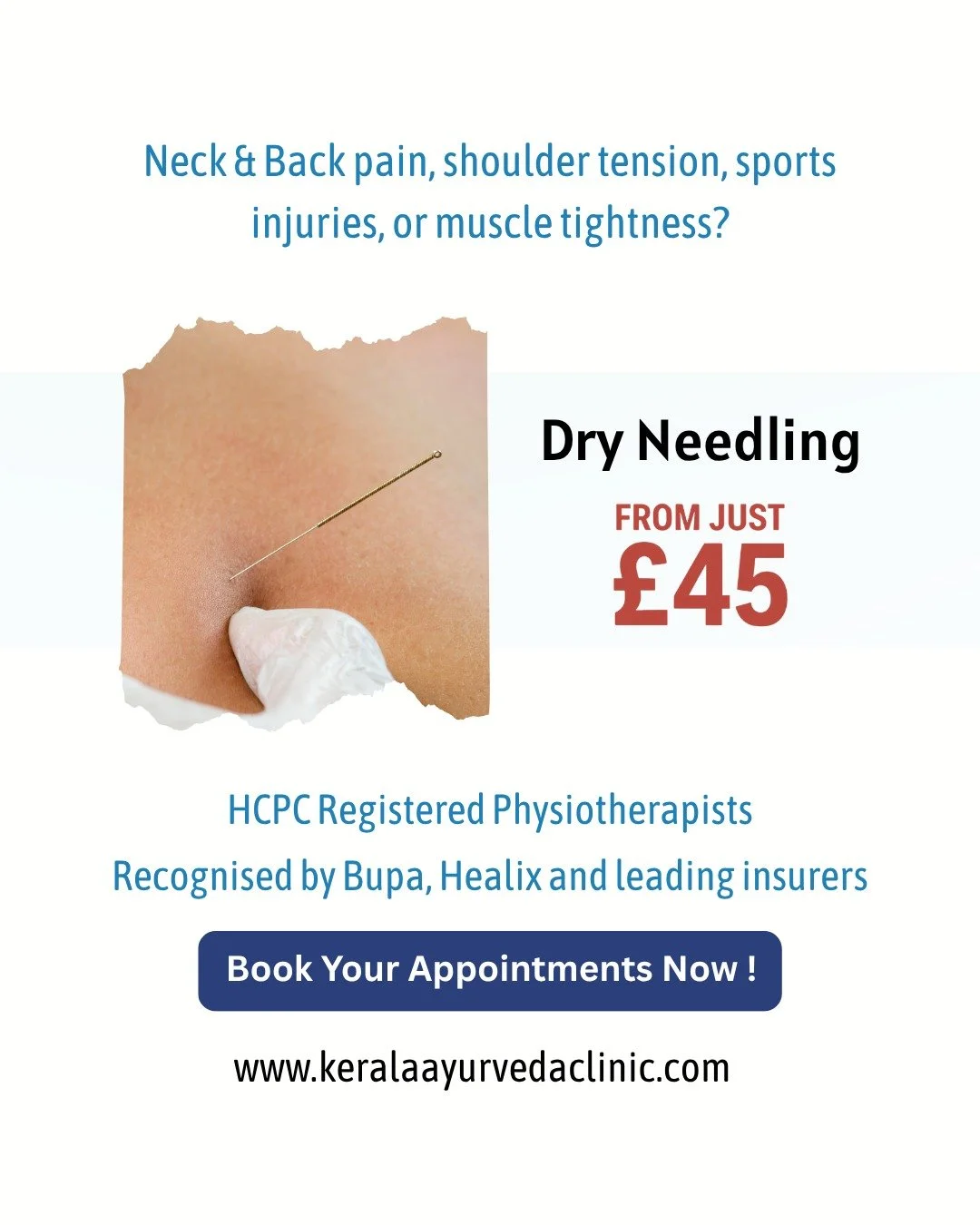 Muscle tightness or persistent pain?

Dry Needling Physiotherapy

A targeted technique used to address myofascial trigger points and reduce muscular pain.

Suitable for:

neck, shoulder and back pain
muscle tightness
restricted movement

From &pound;
