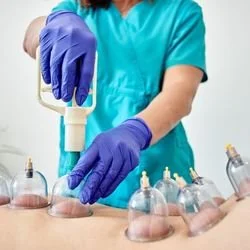 Abhyanga body massage with cupping therapy in Leicester at Kerala Ayurveda Clinic for muscle tension, back pain and circulation support.