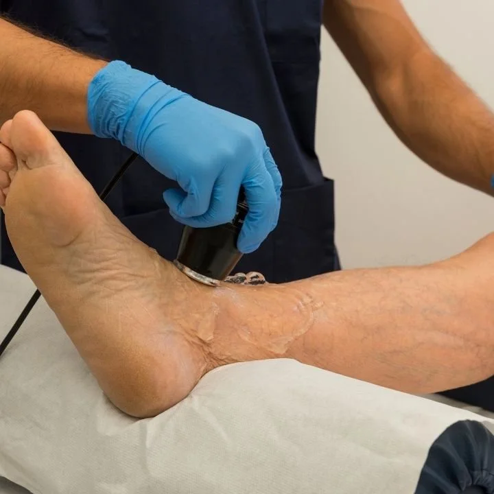 Ultrasound therapy applied to the heel and Achilles area to represent plantar fasciitis, heel pain and calf tightness. Treatments offered include deep tissue leg massage, stretching and physiotherapy at Kerala Ayurveda Clinic in Leicester.