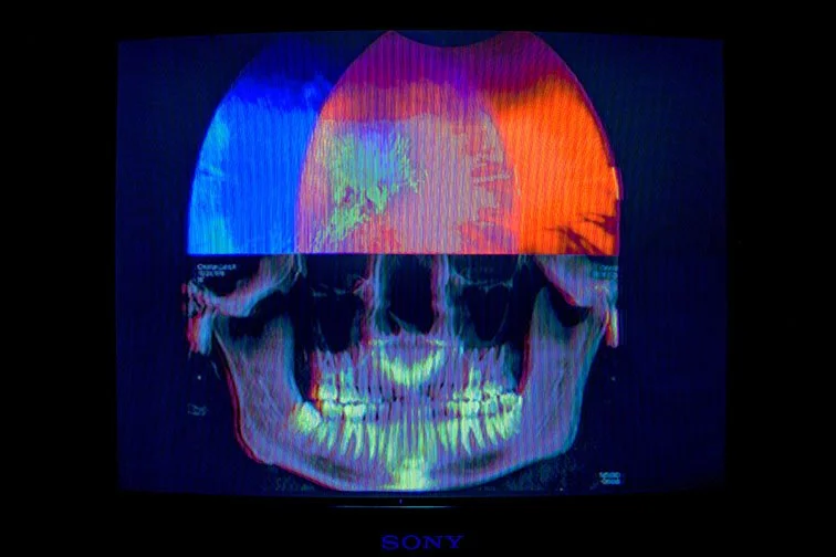 EYES AND MOUTH I. , 25’ 
 
Limited Edition of 9 and 3AP 
Signed by the Artist 
17” x 22” | “30 x 40” 
 
Digital Photography/Medical imaging | A Self-portrait composed of Two Medical, i.e. “DICOM” files: 1: Optometrist’s stereoscopic digital retinal a