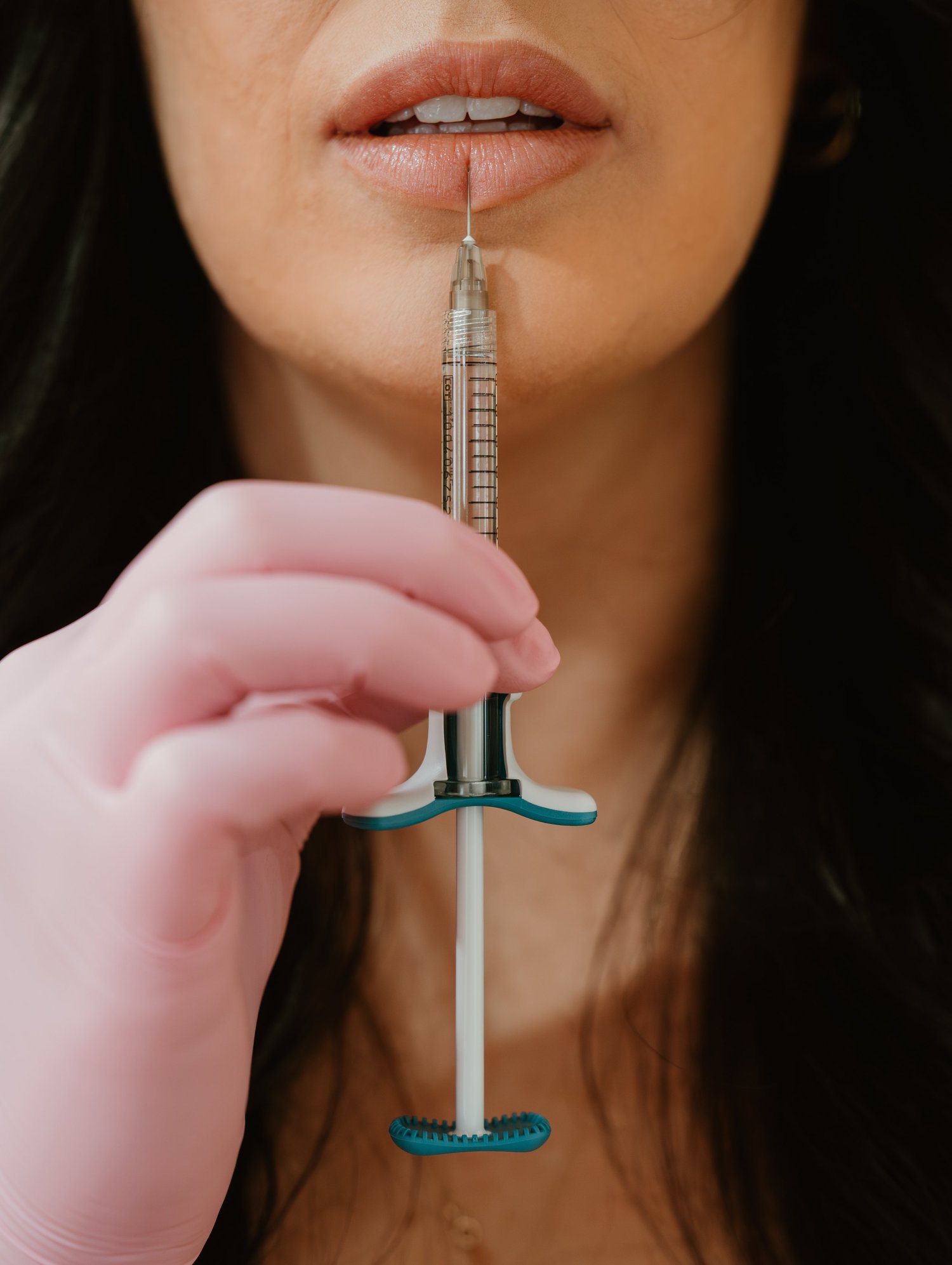 Close-up of a filler syringe held at the lips