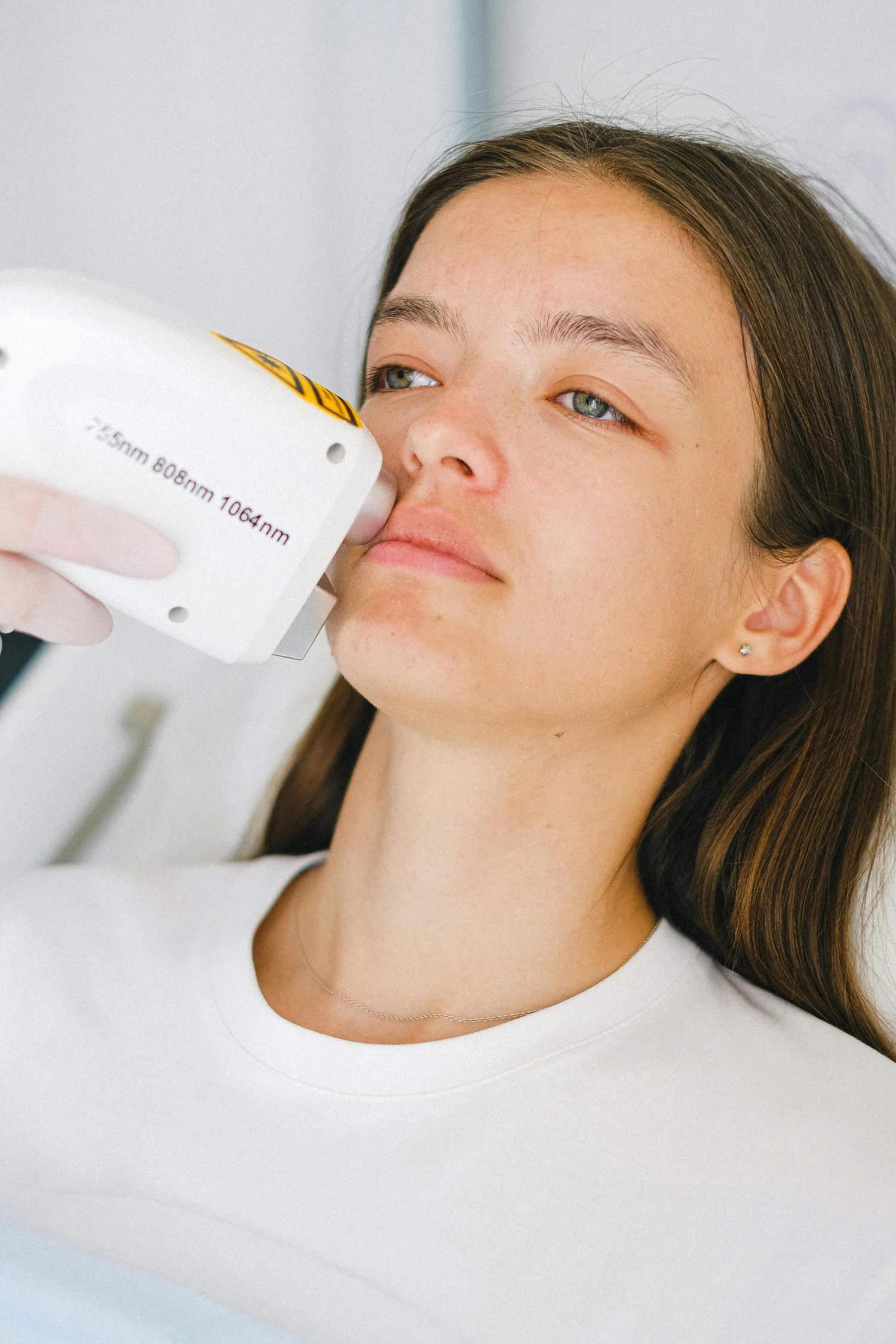 Laser handpiece treating the cheek for pigmentation