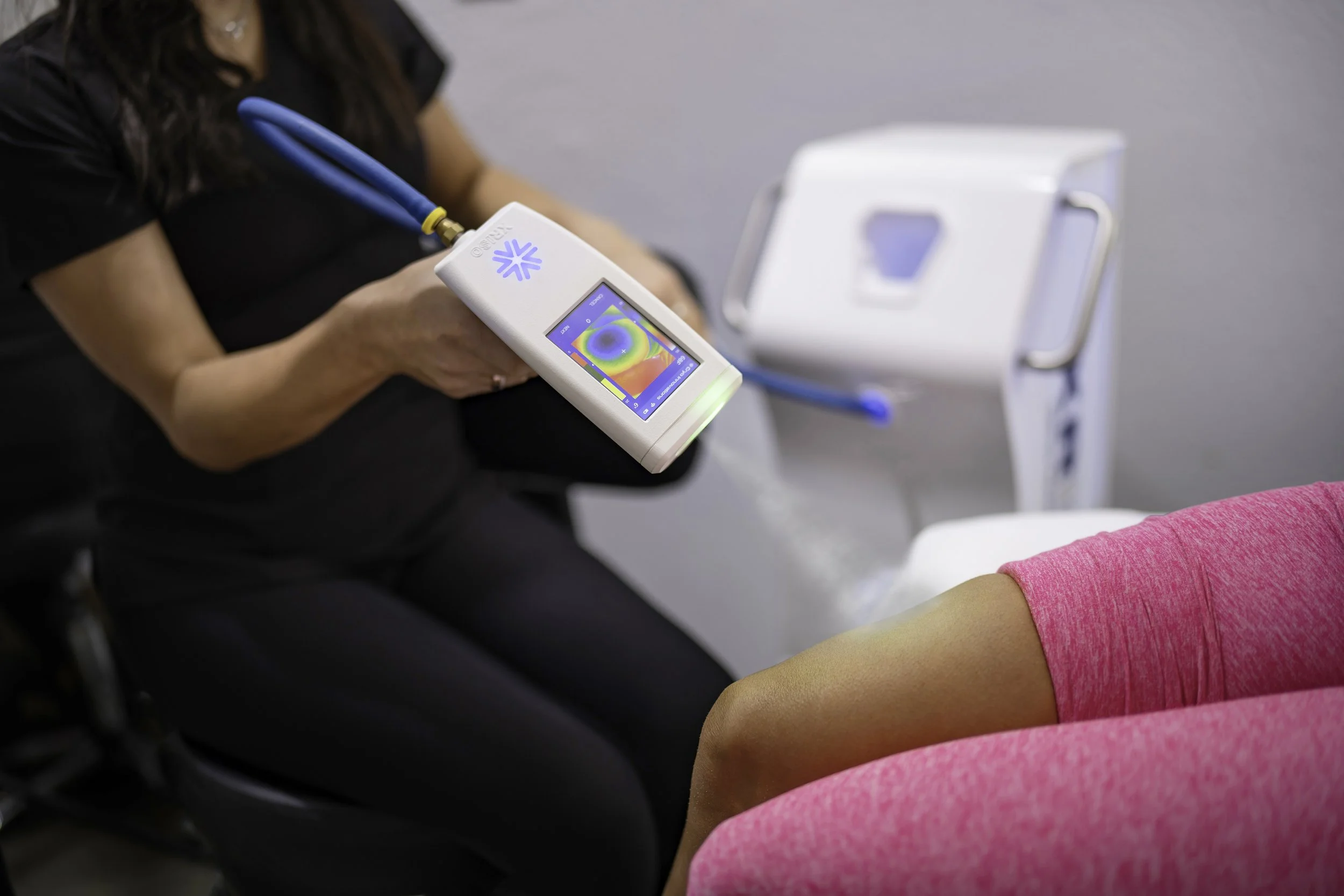 Localized Cryotherapy