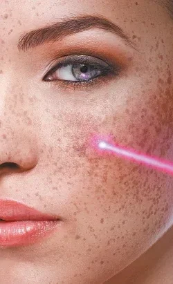 Close-up of a woman's face with makeup and freckles, with a pink laser beam near her cheek.