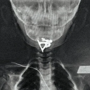 Abbey Stone - Chateau
Produced by BANTA.