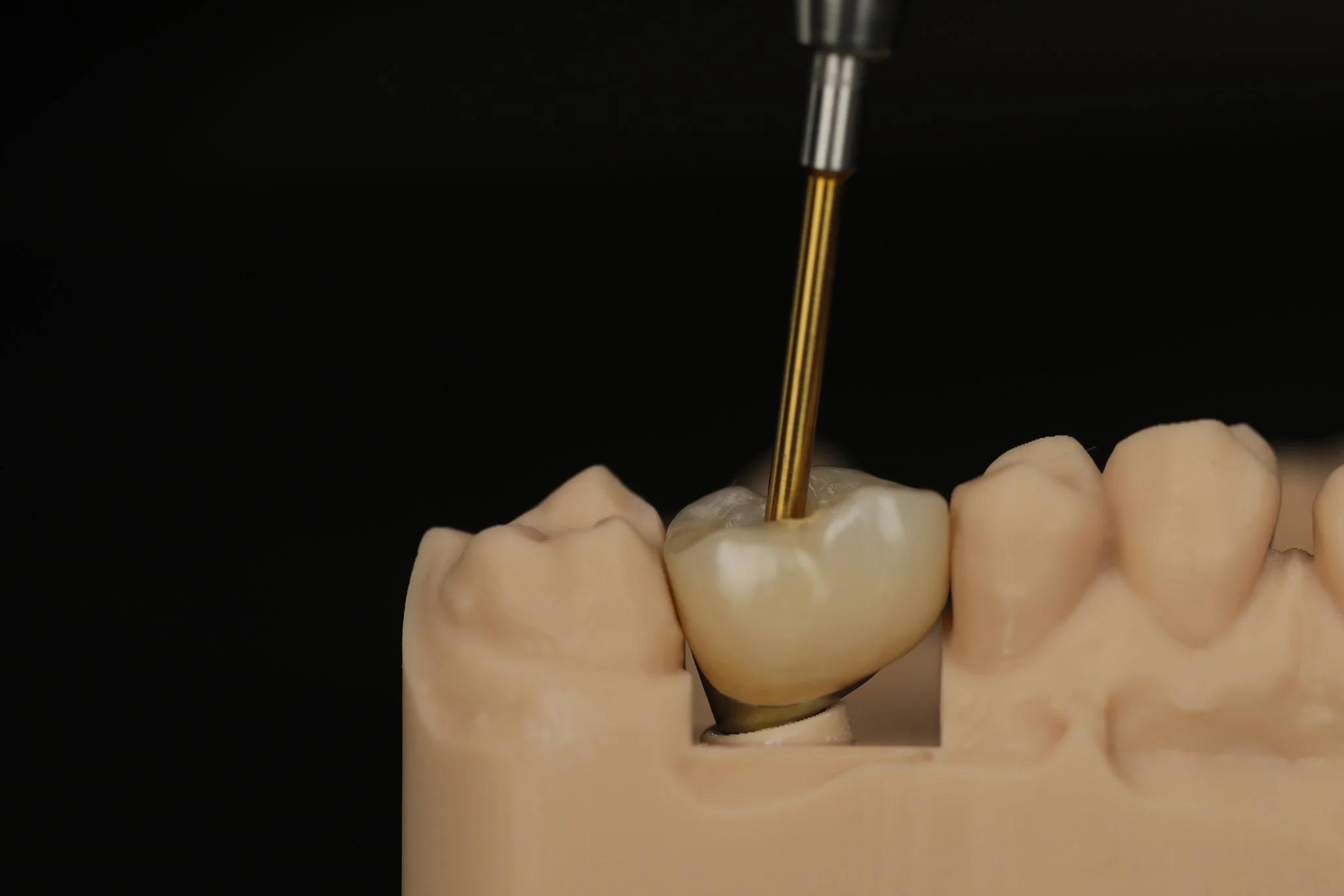 Close-up of a dental model with a dental drill working on a molar tooth. The model has a label with the name 'Judith Greer'.