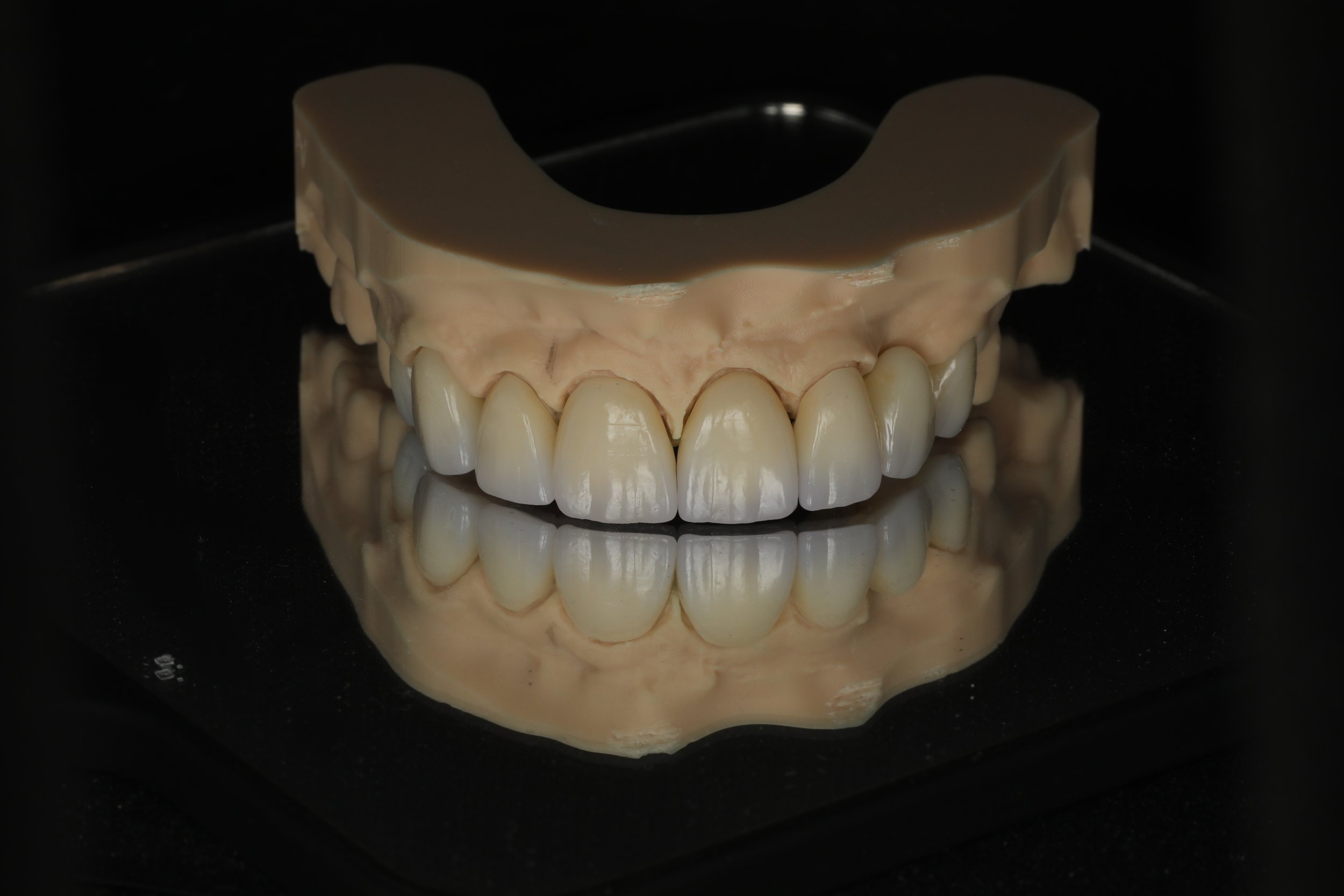 Zirconia monolithic Crowns