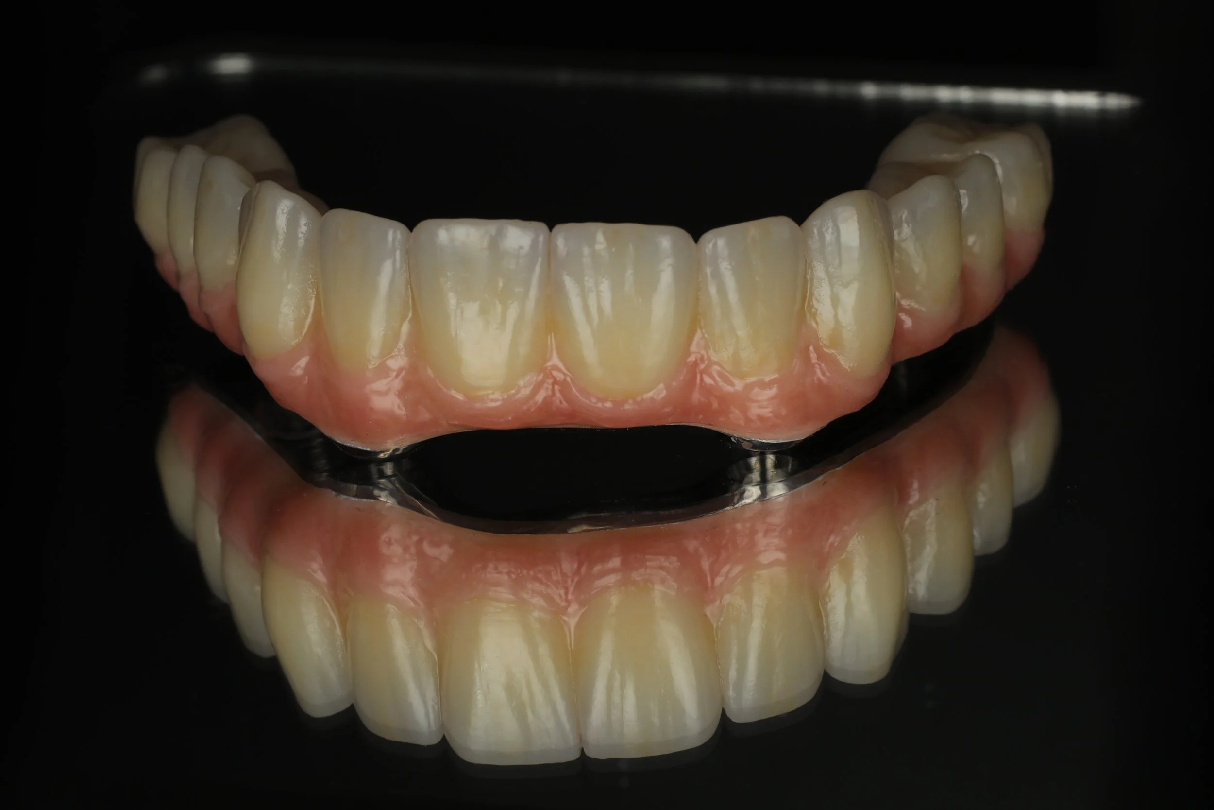 Dental upper and lower acrylic dentures with teeth on a black background.