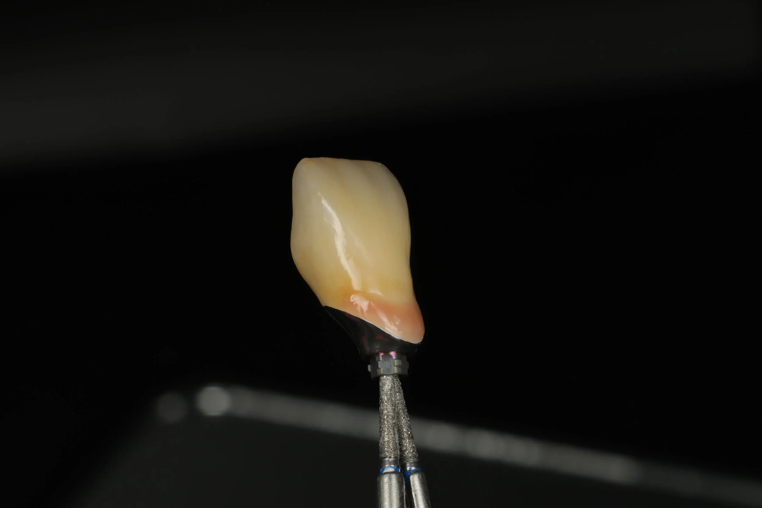 Close-up of a dental implant post with a single tooth crown attached, set against a black background.