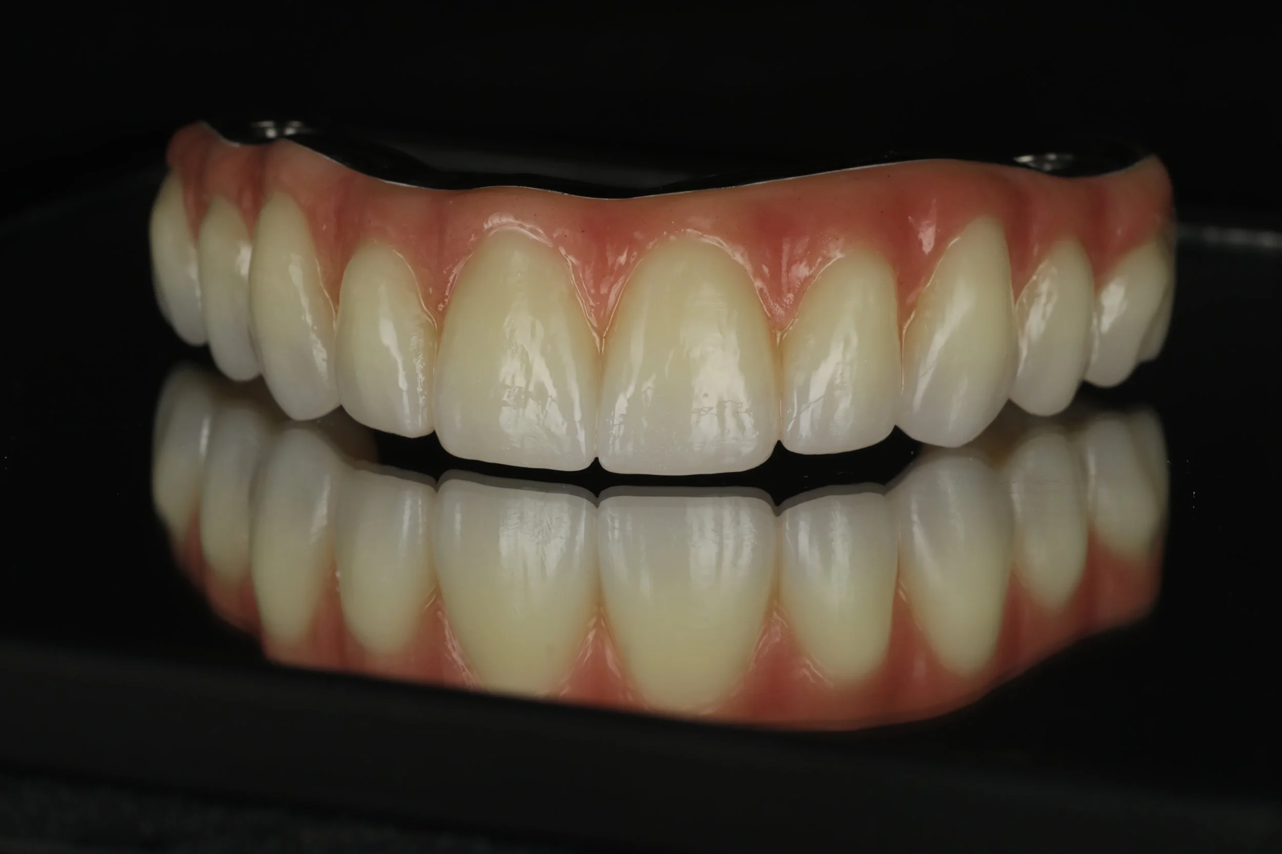 Close-up of a dental model with artificial teeth and gums, reflecting on a black surface.