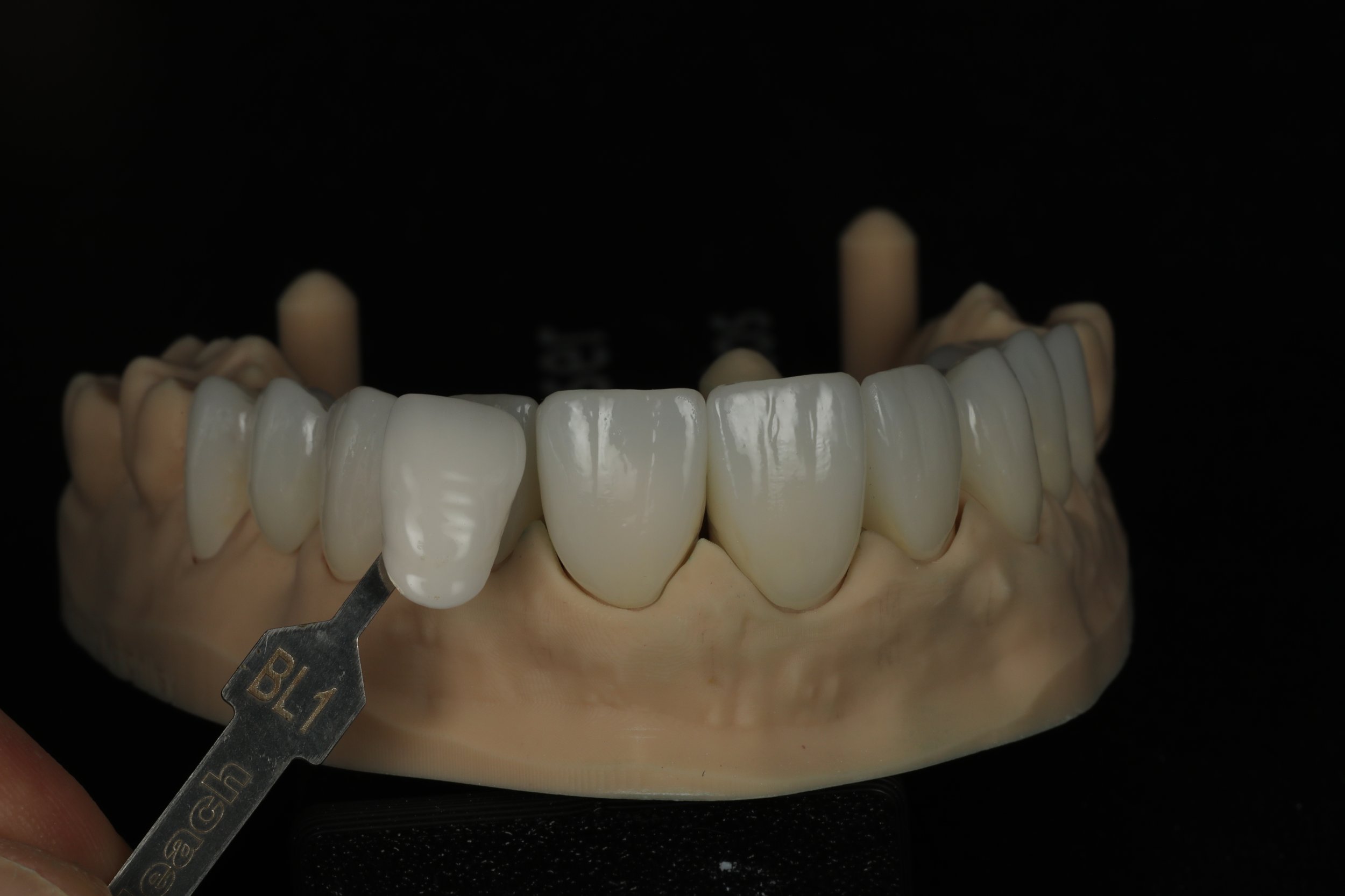 A dental model showing a full set of upper teeth with a shade guide. The model is black background with the teeth and shade guide in focus.