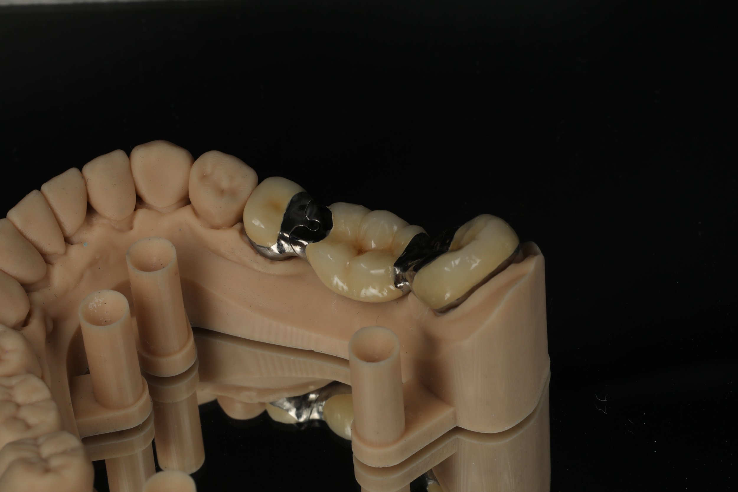 PFM split bridge