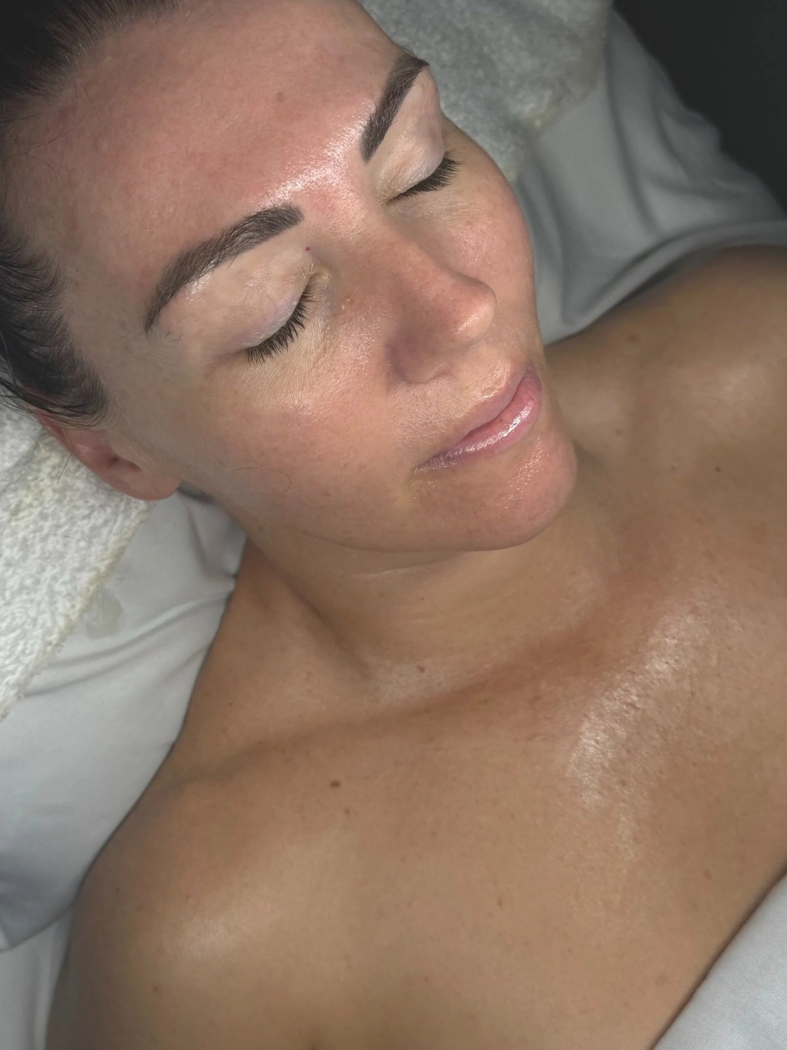 Facial for damaged or sensitised skin – skin barrier repair in Gold Coast