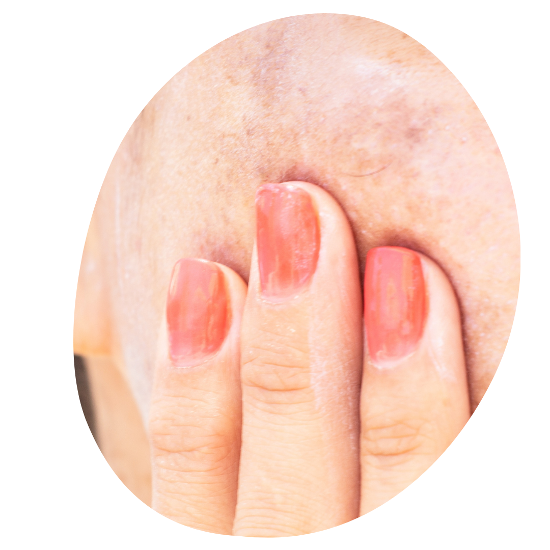 Expert Skin Rejuvenation and Laser Skin Resurfacing in NYC