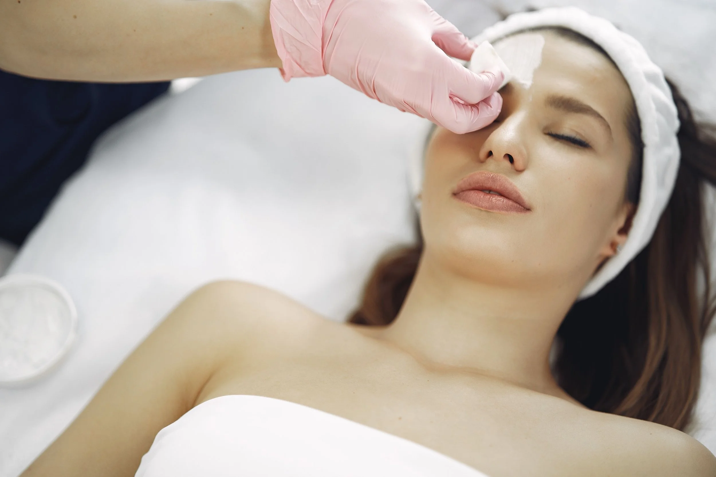 Chemical Peels in the Desert: How to Safely Exfoliate in Phoenix's Climate