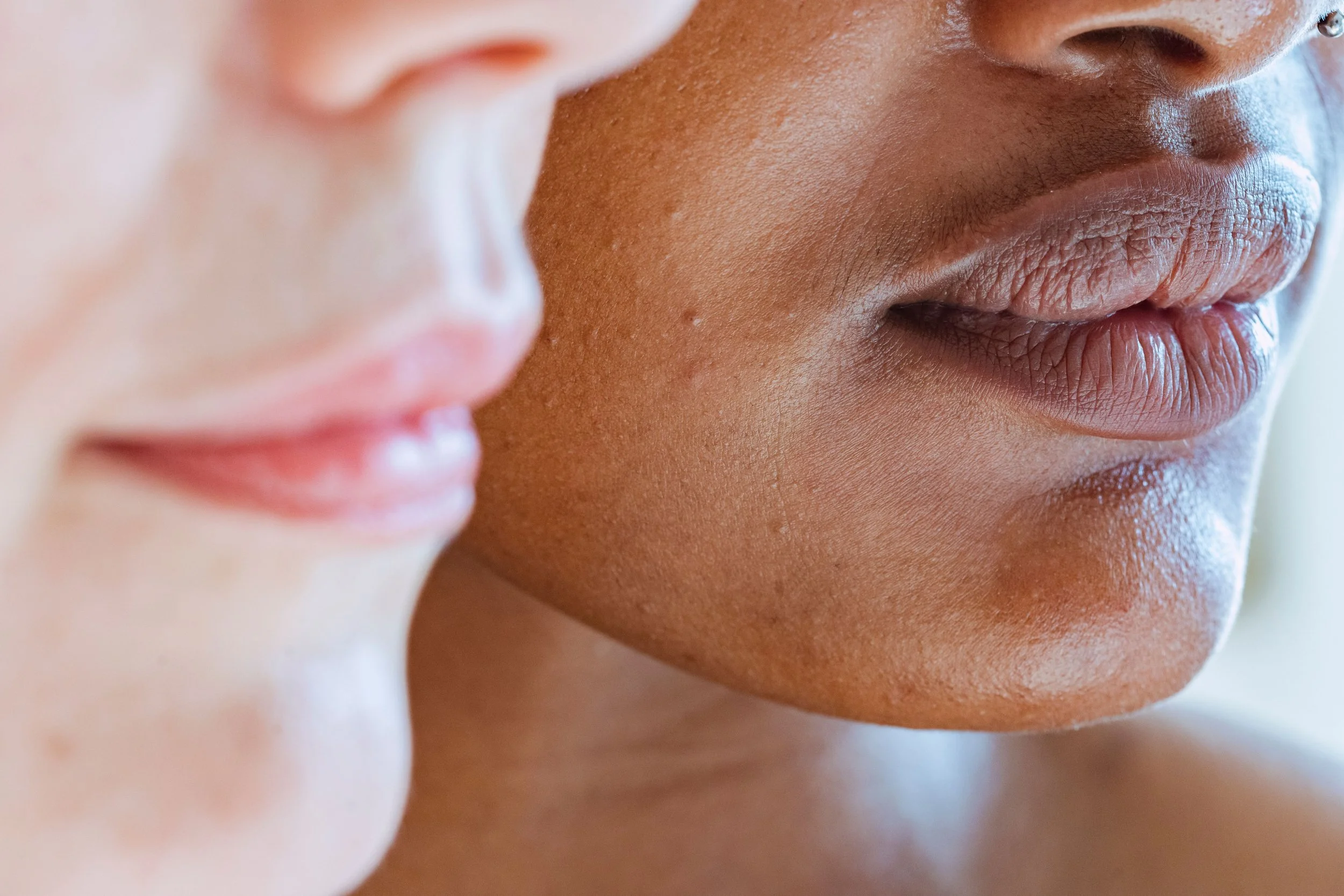 Melasma in Phoenix: Why It's So Common Here and What Actually Treats It